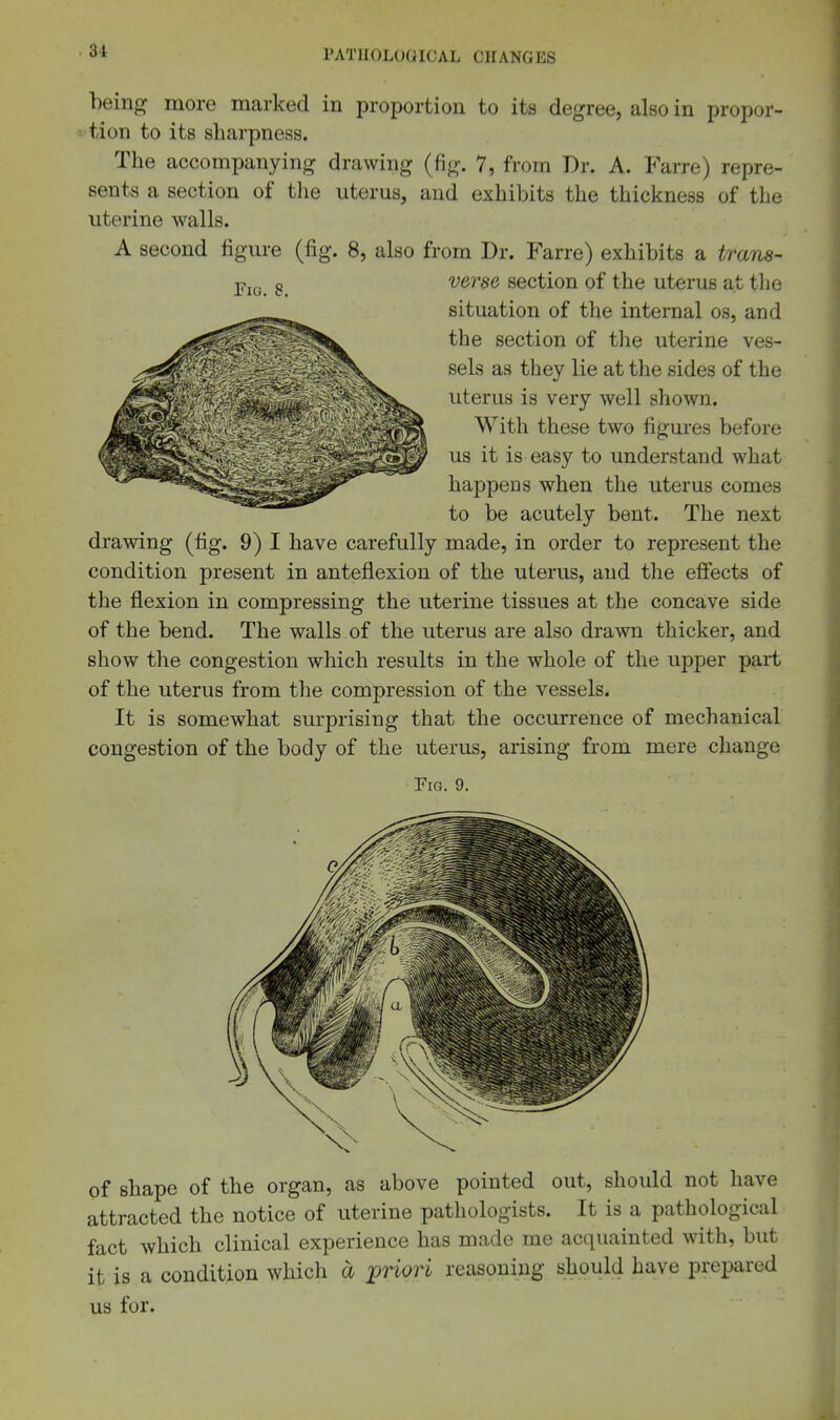 being more marked in proportion to its degree, also in propor- tion to its sharpness. The accompanying drawing (fig. 7, from Dr. A. Farre) repre- sents a section of the uterus, and exhibits the thickness of the uterine walls. A second figure (fig. 8, also from Dr. Farre) exhibits a trana- versG section of the uterus at the situation of the internal os, and the section of the uterine ves- sels as they lie at the sides of the uterus is very well shown. With these two figures before us it is easy to understand what happens when the uterus comes to be acutely bent. The next drawing (fig. 9) I have carefully made, in order to represent the condition present in anteflexion of the uterus, and the effects of the flexion in compressing the uterine tissues at the concave side of the bend. The walls of the uterus are also drawn thicker, and show the congestion which results in the whole of the upper part of the uterus from the compression of the vessels. It is somewhat surprising that the occurrence of mechanical congestion of the body of the uterus, arising from mere change Fig. 9. of shape of the organ, as above pointed out, should not have attracted the notice of uterine pathologists. It is a pathological fact which clinical experience has made me acquainted with, but it is a condition which a priori reasoning should have prejiared us for.