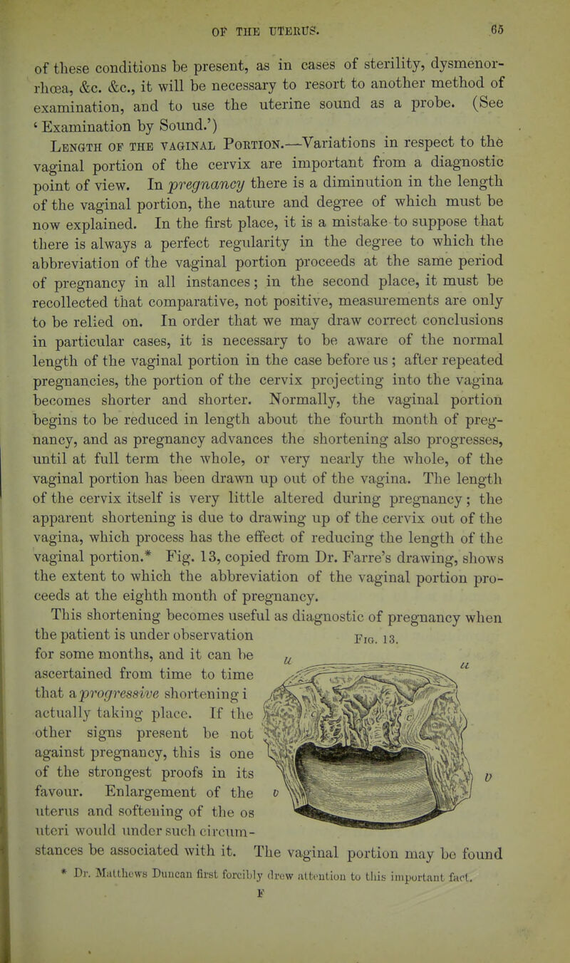 of these conditions be present, as in cases of sterility, dysmenor- rhcea, &c. &c., it will be necessary to resort to another method of examination, and to use the uterine sound as a probe. (See 'Examination by Sound.') Length of the vaginal Portion.—Variations in respect to the vaginal portion of the cervix are important from a diagnostic point of view. In ^pregnancy there is a diminution in the length of the vaginal portion, the nature and degree of which must be now explained. In the first place, it is a mistake to suppose that there is always a perfect regularity in the degree to which the abbreviation of the vaginal portion proceeds at the same period of pregnancy in all instances; in the second place, it must be recollected that comparative, not positive, measurements are only to be relied on. In order that we may draw coirect conclusions in particular cases, it is necessary to be aware of the normal length of the vaginal portion in the case before us; after repeated pregnancies, the portion of the cervix projecting into the vagina becomes shorter and shorter. Normally, the vaginal portion begins to be reduced in length about the fourth month of preg- nancy, and as pregnancy advances the shortening also progresses, until at full term the whole, or very nearly the whole, of the vaginal portion has been drawn up out of the vagina. The length of the cervix itself is very little altered during pregnancy; the apparent shortening is due to drawing up of the cervix out of the vagina, which process has the effect of reducing the length of the vaginal portion.* Fig. 13, copied from Dr. Farre's drawing, shows the extent to which the abbreviation of the vaginal portion pro- ceeds at the eighth month of pregnancy. This shortening becomes useful as diagnostic of pregnancy when the patient is under observation Pio 13 for some months, and it can be ascertained from time to time that ?k'progressive shortening i actually taking place. If the other signs present be not ^^^l^^^^ii^ ■ against pregnancy, this is one of the strongest proofs in its favour. Enlargement of the uterus and softening of the os uteri would imdcr such circum- stances be associated with it. The vaginal portion may bo found * Dj'. MaUliews Duucan first forcibly drew atfcpntiou to this important fact, F V