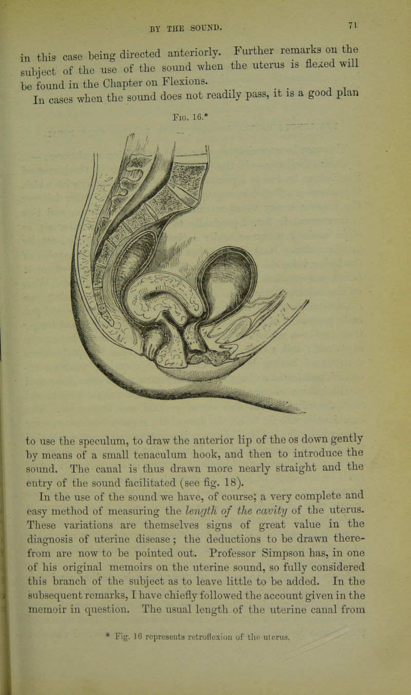 m this case being directed anteriorly. Further remarks on the subject of the use of the sound when the utems is flexed will be found in the Chapter on Flexions. In cases when the sound does not readily pass, it is a good plan Fig. 16.* to use the speculum, to draw the anterior lip of the os down gently by means of a small tenaculum hook, and then to introduce the sound. The canal is thus drawn more nearly straight and the entry of the sound facilitated (see fig. 18). In the use of the sound we have, of course; a very complete and easy method of measuring the length of the cavity of the uterus. These variations are themselves signs of great value in the diagnosis of uterine disease; the deductions to be drawn there- from are now to be pointed out. Professor Simpson has, in one of his original memoirs on the uterine sound, so fully considered this branch of the subject as to leave little to be added. In the subsequent remarks, I have chiefly followed the account given in the memoir in question. The usual length of the uterine canal from * Fig. IG represents retroflexion of the utcrns.