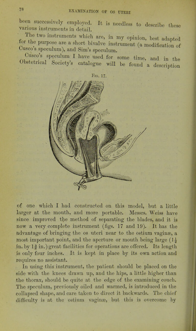 been successively employed. It is needless to describe these various instruments in detail. The two instruments which are, in my opinion, best adapted tor the purpose are a short bivalve instrument (a modification of Uusco s speculum), and Sim's speculum. Cusco's speculum I have used for some time, and in the Obstetrical Society's catalogue will be found a description Fig. 17. of one which I had constructed on this model, but a little larger at the mouth, and more portable. Messrs. Weiss have since improved the method of separating the blades, and it is now a very complete instrument (figs. 17 and 19). It has the advantage of bringing the os uteri near to the ostium vaginae, a most important point, and the aperture or mouth being large (1 ^ in. by If in.) great facilities for operations are offered. Its length is only four inches. It is kept in place by its own action and requires no assistant. In using this instrument, the patient should be placed on the side with the knees drawn up, and the hips, a little higlier than the thorax, should be quite at the edge of the examining couch. The speculum, previously oiled and warmed, is introduced in the collapsed shape, and care taken to direct it backwards. The chief difficulty is at tlie ostium vagina), but this is overcome by