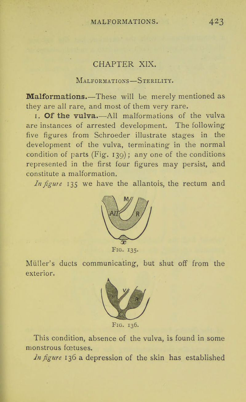 CHAPTER XIX. Malformations—Sterility. Malformations.—These will be merely mentioned as they are all rare, and most of them very rare. I. Of the vulva.—All malformations of the vulva are instances of arrested development. The following- five figures from Schroeder illustrate stages in the development of the vulva, terminating- in the normal condition of parts (Fig. 139); any one of the conditions represented in the first four figures may persist, and constitute a malformation. In figwe 135 we have the allantois, the rectum and Fig. 135. Muller's ducts communicating-, but shut off from the exterior. Fig. 136. This condition, absence of the vulva, is found in some monstrous foetuses. In figure 136 a depression of the skin has established