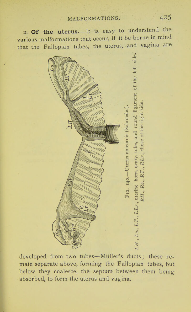 2. Of the uterus.—It is easy to understand the various malformations that occur, if it be borne in mind that the Fallopian tubes, the uterus, and vagina are developed from two tubes—Miiller's ducts; these re- main separate above, forming- the Fallopian tubes, but below they coalesce, the septum between them bemg absorbed, to form the uterus and vagina.