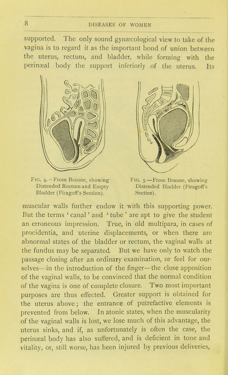 supported. The only sound gynaecological view to take of the vagina is to regard it as the important bond of union between the uterus, rectum, and bladder, while forming with the perineal body the support inferiorly of the uterus. Its muscular walls further endow it with this supporting power. But the terms ' canal' and ' tube ' are apt to give the student an erroneous impression. True, in old multipara, in cases of procidentia, and uterine displacements, or when there are abnormal states of the bladder or rectum, the vaginal walls at the fundus may be separated. But we have only to watch the passage closing after an ordinary examination, or feel for our- selves—in the introduction of the finger—the close apposition of the vaginal walls, to be convinced that the normal condition of the vagina is one of complete closure. Two most important purposes are thus effected. Greater support is obtained for the uterus above; the entrance of putrefactive elements is prevented from below. In atonic states, when the muscularity of the vaginal walls is lost, we lose much of this advantage, the uterus sinks, and if, as unfortunately is often the case, the perineal body has also suffered, and is deficient in tone and vitality, or, still worse, has been injured by previous deliveries, Fig. 4,-From Braune, showing Distended Rectum and Empty Bladder (Piragoff's Section). Fig. 5.—From Braune, showing Distended Bladder (PiragofFs Section).