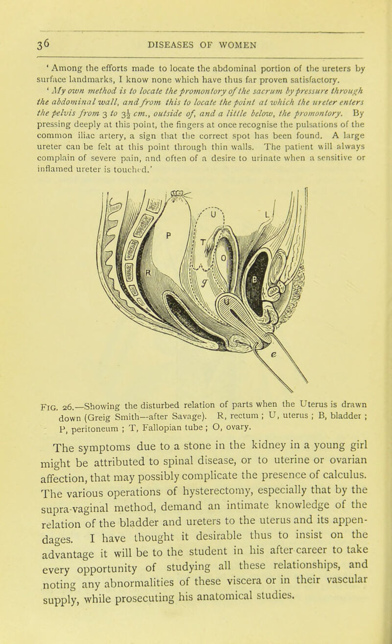 ' Among the efforts made to locate the abdominal portion of the ureters by surface landmarks, I know none which have thus far proven satisfactory. ' My own method is to locate the promontory of the sacrum by pressure through the abdominal wall, and from this to locate the point at which the meter enters the pelvis from 3 to 3.^ cm., outside of, and a little below, the promontory. By pressing deeply at this point, the fingers at once recognise the pulsations of the common iliac artery, a sign that the correct spot has been found. A large ureter can be felt at this point through thin walls. The patient will always complain of severe pain, and often of a desire to urinate when a sensitive or inflamed ureter is touched.' FjGi 26, Showing the disturbed relation of parts when the Uterus is drawn down (Greig Smith—after Savage). R, rectum ; U, uterus ; B, bladder ; P, peritoneum ; T, Fallopian tube ; O, ovary. The symptoms due to a stone in the kidney in a young girl might be attributed to spinal disease, or to uterine or ovarian affection, that may possibly complicate the presence of calculus. The various operations of hysterectomy, especially that by the supra vaginal method, demand an intimate knowledge of the relation of the bladder and ureters to the uterus and its appen- dages. I have thought it desirable thus to insist on the advantage it will be to the student in his after career to take every opportunity of studying all these relationships, and noting any abnormalities of these viscera or in their vascular supply, while prosecuting his anatomical studies.