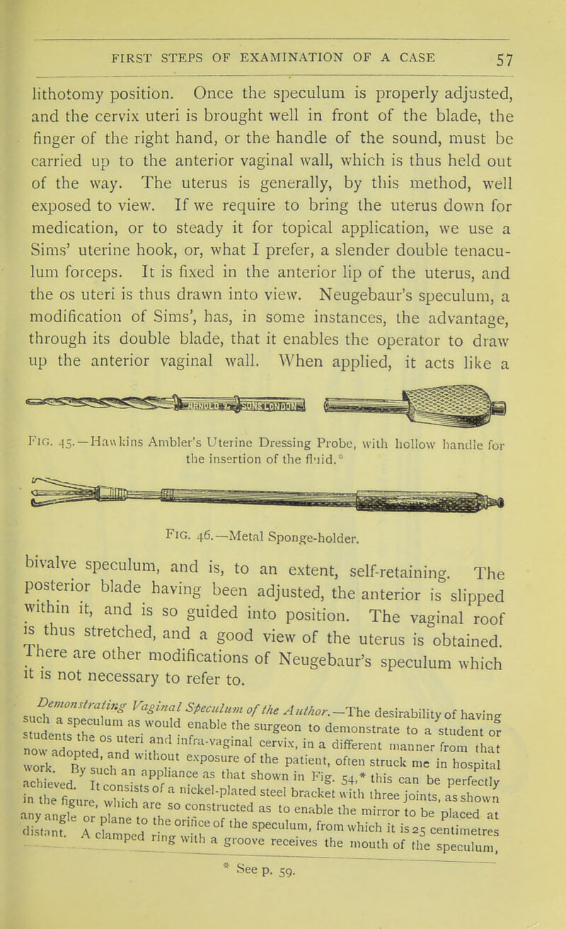 lithotomy position. Once the speculum is properly adjusted, and the cervix uteri is brought well in front of the blade, the finger of the right hand, or the handle of the sound, must be carried up to the anterior vaginal wall, which is thus held out of the way. The uterus is generally, by this method, well exposed to view. If we require to bring the uterus down for medication, or to steady it for topical application, we use a Sims' uterine hook, or, what I prefer, a slender double tenacu- lum forceps. It is fixed in the anterior lip of the uterus, and the os uteri is thus drawn into view. Neugebaur's speculum, a modification of Sims', has, in some instances, the advantage, through its double blade, that it enables the operator to draw up the anterior vaginal wall. When applied, it acts like a -Hawkins Ambler's Uterine Dressing Probe, with hollow handle for the insertion of the fluid.® Fig. 46.— Metal Sponge-holder. bivalve speculum, and is, to an extent, self-retaining. The posterior blade having been adjusted, the anterior is slipped within it, and is so guided into position. The vaginal roof is thus stretched, and a good view of the uterus is obtained I here are other modifications of Neugebaur's speculum which it is not necessary to refer to. suctr^t'Kg Va&inai SpeCHlU1 °ftke A**»-T** desirability of having tudenat PtbetnutaS-W°U rble SUrge°n t0 dem°nStrate to a s^ent or now adopted anT' T cervix' in * different 'anner from that wok B^r ; T eXP°T °f thC PatiCnt' °f*en Struck n,e in hosP^l Thieved n ^ 'anCe aS tlmt Sh0Wn in FiS- 54.* this can be perfectly ~ °f a ^-Plated steel bracket with ,hree joints, as shown any nglf or ptne to the50 TTF  t0 ^ ^ ^ l° 06 P,aCed a' distnnf Aclmpcd rin^f SPeCUlUm' fr°m ***** * * 25 Cemilelres camped ring with a groove receives the mouth of the speculum, * See p. 59.