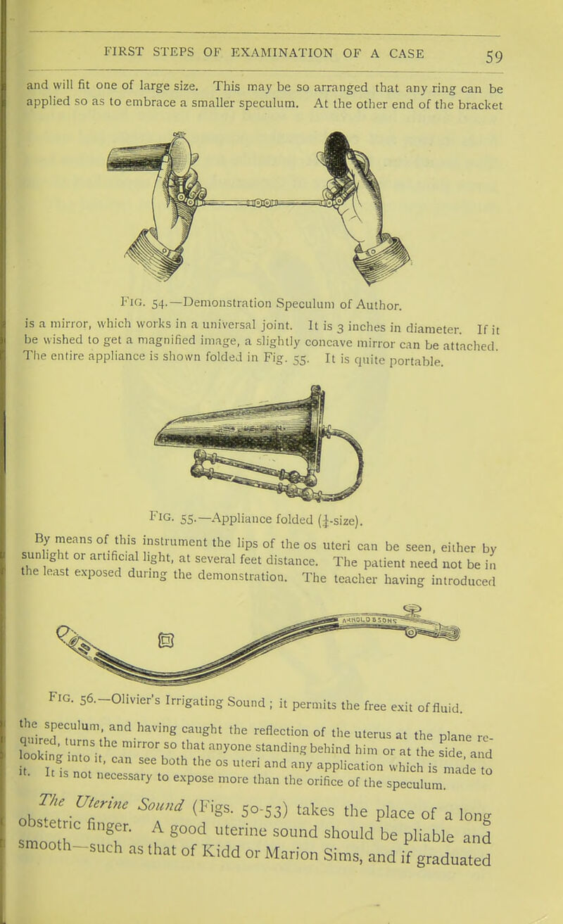 and will fit one of large size. This may be so arranged that any ring can be applied so as to embrace a smaller speculum. At the other end of the bracket Fig. 54.—Demonstration Speculum of Author, is a mirror, which works in a universal joint. It is 3 inches in diameter. If it be wished to get a magnified image, a slightly concave mirror can be attached. The entire appliance is shown folded in Fig. 55. It is quite portable. FlG- 55-— Appliance folded Q-size). By means of this instrument the lips of the os uteri can be seen, either by sunhght or artificial light, at several feet distance. The patient need not be in the least exposed during the demonstration. The teacher having introduced Fig. s^-Olivier's Irrigating Sound ; it permits the free exit of fluid. the speculum and having caught the reflection of the uterus at the plane re lookin; mirr°r 50 that any°ne S^ingbehind » or at the sVe and t I' b°th °S '^ and any aPPlicati0« -hich s made 0 ■t- It .s not necessary to expose more than the orifice of the speculum. The Uterine Sound (Figs. 50-53) takes the place of a long smoo hC T u g°°d UtGrine S°Und Sh0uld be Pliable and smooth-such as that of Kidd or Marion Sims, and if graduated