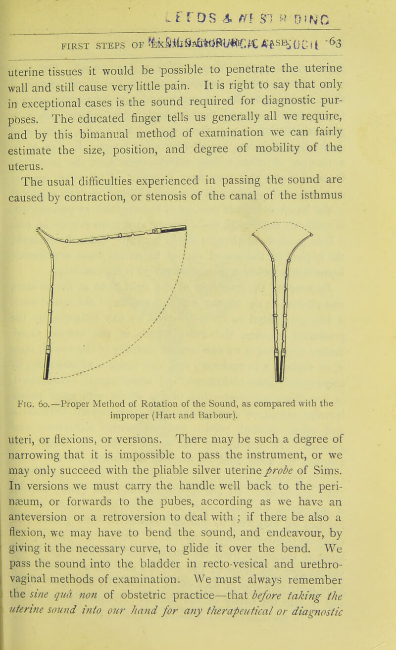 uterine tissues it would be possible to penetrate the uterine wall and still cause very little pain. It is right to say that only in exceptional cases is the sound required for diagnostic pur- poses. The educated finger tells us generally all we require, and by this bimanual method of examination we can fairly estimate the size, position, and degree of mobility of the uterus. The usual difficulties experienced in passing the sound are caused by contraction, or stenosis of the canal of the isthmus Fig. 60.—Proper Method of Rotation of the Sound, as compared with the improper (Hart and Barbour). uteri, or flexions, or versions. There may be such a degree of narrowing that it is impossible to pass the instrument, or we may only succeed with the pliable silver uterine probe of Sims. In versions we must carry the handle well back to the peri- neum, or forwards to the pubes, according as we have an anteversion or a retroversion to deal with ; if there be also a flexion, we may have to bend the sound, and endeavour, by giving it the necessary curve, to glide it over the bend. We pass the sound into the bladder in recto-vesical and urethro- vaginal methods of examination. We must always remember the sine qua non of obstetric practice—that before faking the uterine sound into our hand for any therapeutical or diagnostic