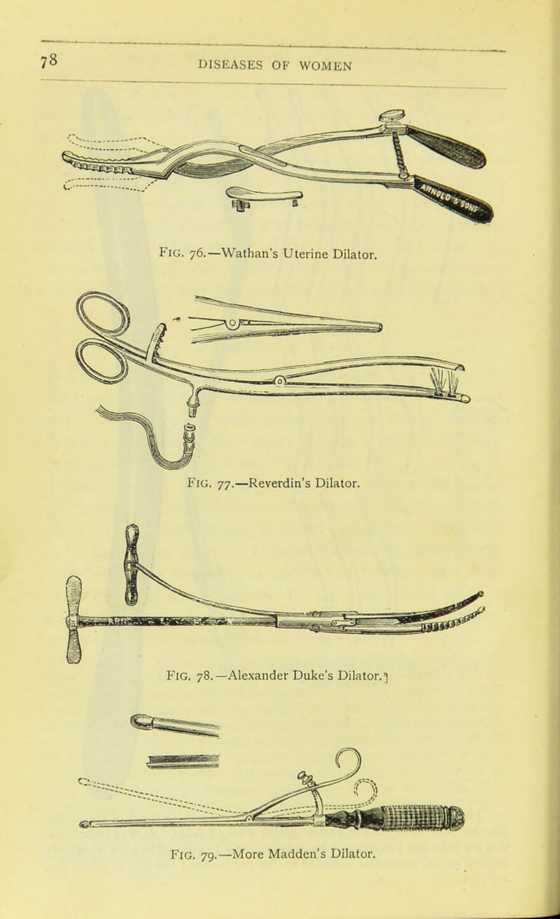 Fig. 76.—Wathan's Uterine Dilator. Fig. 77.—Reverdin's Dilator. Fig, 78.—Alexander Duke's Dilator.] c;>. Fig. 79.—More Maddens Dilator.