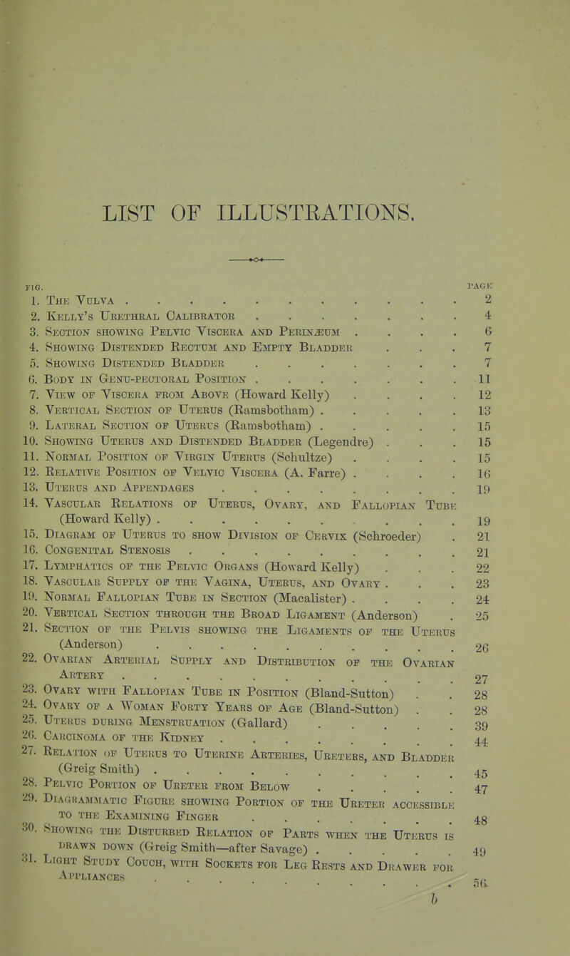 LIST OF ILLUSTRATIONS. to* yiG. TAGl! 1. The Vulva 2 2. Kelly's Urethral Calibrator ....... 4 3. Section showing Pelvic Viscera and Perineum .... 6 4. Showing Distended Eectum and Empty Bladder ... 7 5. Showing Distended Bladder ....... 7 (). Body in Genu-peotoral Position ....... 11 7. View of Viscera from Above (Howard Kelly) .... 12 8. Vertical Section of Uterus (Eamsbotham) ..... 13 !). Lateral Section of Uterus (Kamsbotliam) . . . . .1.5 10. Showing Uterus and Distended Bladder (Legendre) ... 15 11. Normal Position of Virgin Uterus (Schultze) . . . .15 12. Eelative Position of Velvic Viscera (A. Farre) . . . .16 13. Uterus and Appendages ........ 19 14. Vascular Eelations op Uterus, Ovary, and Fallopian Tubi: (Howard Kelly) .......... 19 1.5. Diagram of Uterus to show Division of Cervix (Schroeder) . 21 IG. Congenital Stenosis ......... 21 17. Lymphatics op the Pelvic Organs (Howard Kelly) ... 22 18. Vascular Supply op the Vagina, Uterus, and Ovary ... 23 19. Normal Fallopian Tube in Section (Macalister) .... 24 20. Vertical Section through the Broad Ligament (Anderson) . 25 21. Section op the Pelvis showing the Ligaments op the Uterus (Anderson) 2G 22. Ovarian Arterial Supply and Distribution op the Ovarian Artery 27 23. Ovary with Fallopian Tube in Position (Bland-Sutton) . 28 24. Ovary op a Woman Forty Years op Age (Bland-Sutton) . . 28 25. Uterus during Menstruation (Gallard) 39 2G. Carcinoma op the Kidney 4^ 27. Eelation op Uterus to Uterine Arteries, Ureters, and Bladder (Greig Smith) 45 28. Pelvic Portion op Ureter from Below 47 29. Diagrammatic Figure showing Portion op the Ureter accessible TO THE Examining Finger 43 :J0. Showing the Disturbed Eelation op Parts when the Uterus is DRAWN DOWN (Greig Smith—after Savage) 4!) -1. Light Study Couch, with Sockets for Leg Bests and Drawer for Appliances . h