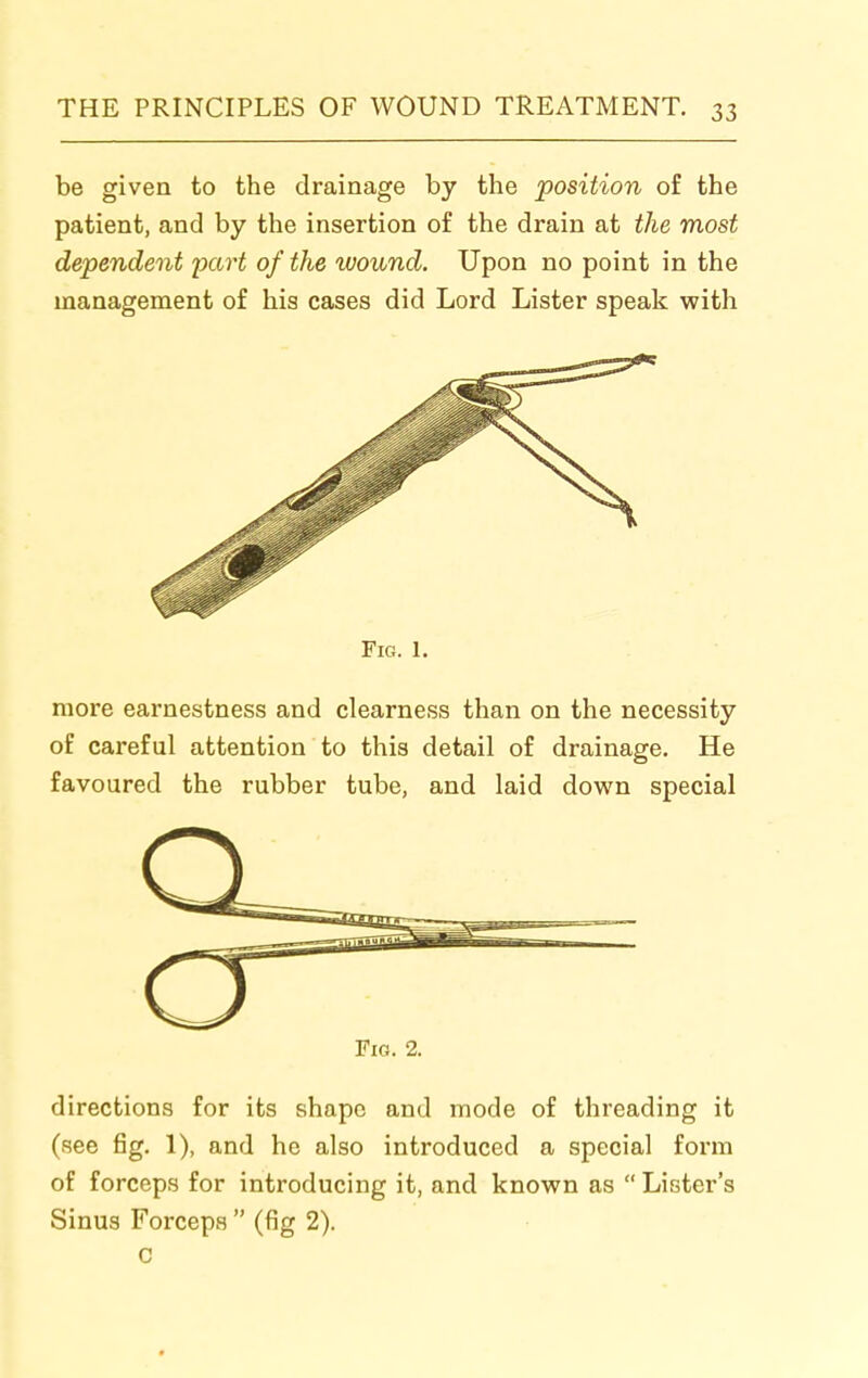 be given to the drainage by the position of the patient, and by the insertion of the drain at the most dependent yart of the wound. Upon no point in the management of his cases did Lord Lister speak with Fig. 1. more earnestness and clearness than on the necessity of careful attention to this detail of drainage. He favoured the rubber tube, and laid down special Fig. 2. directions for its shape and mode of threading it (see fig. 1), and he also introduced a special form of forceps for introducing it, and known as  Lister's Sinus Forceps  (fig 2). C