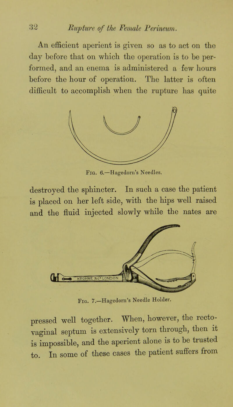 An efficient aperient is given so as to act on the day before that on which the operation is to be per- formed, and an enema is administered a few liours before the hour of operation. The latter is often difficult to accomplish when the rupture has quite FiQ. 6.—Hagedorn's Needles. destroyed the sphincter. In such a case the patient is placed on her left side, with the hips well raised and the fluid injected slowly while the nates are Fig. 7.—Hagedorn's Needle Holder. pressed well together. When, however, the recto- vaginal septum is extensively torn through, then it is impossible, and the aperient alone is to be trusted to. In some of these cases the patient suffers from