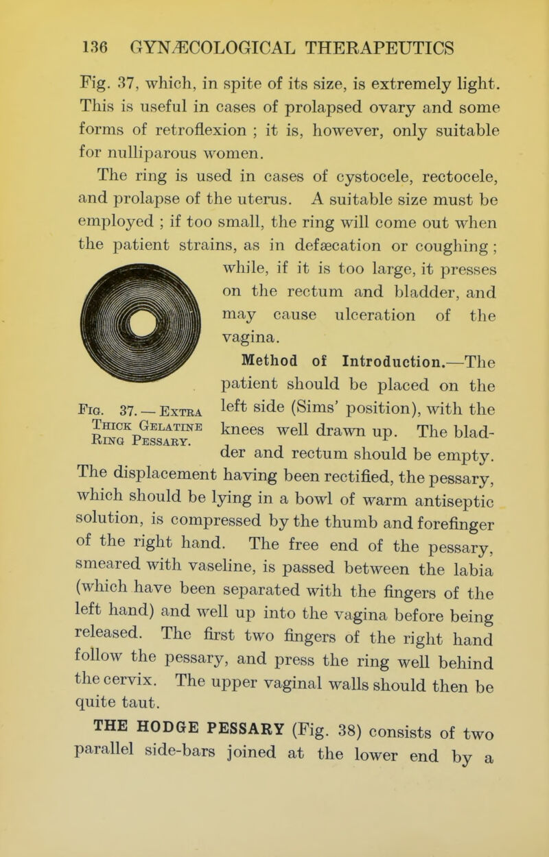 Fig. 37, which, in spite of its size, is extremely light. This is useful in cases of prolapsed ovary and some forms of retroflexion ; it is, however, only suitable for nuUiparous women. The ring is used in cases of cystocele, rectocele, and prolapse of the uterus. A suitable size must be employed ; if too small, the ring will come out when the patient strains, as in defsecation or coughing ; while, if it is too large, it presses on the rectum and bladder, and may cause ulceration of the vagina. Method of Introduction—The patient should be placed on the left side (Sims' position), with the knees well drawn up. The blad- der and rectum should be empty. The displacement having been rectified, the pessary, which should be lying in a bowl of warm antiseptic solution, is compressed by the thumb and forefinger of the right hand. The free end of the pessary, smeared with vaseline, is passed between the labia (which have been separated with the fingers of the left hand) and well up into the vagina before being released. The first two fingers of the right hand follow the pessary, and press the ring well behind the cervix. The upper vaginal walls should then be quite taut. THE HODGE PESSARY (Fig. 38) consists of two parallel side-bars joined at the lower end by a Pig. 37. _ Extra Thick Gelatine Rmo Pessary.