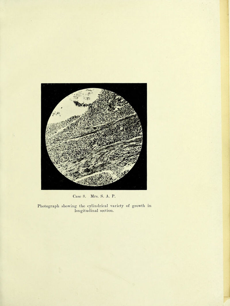Photograph showing the cylindrical variety of growth in longitudinal section.