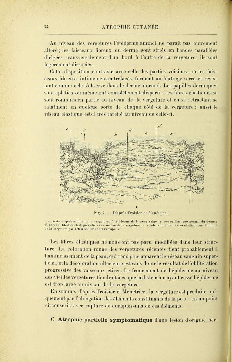 Au niveau des vergetures l'épiderme aminci ne paraît pas autrement altéré ; les faisceaux fibreux du derme sont striés en bandes parallèles dirigées transversalement d'un bord à l'autre de la vergeture; ils sont légèrement dissociés. Cette disposition contraste avec celle des parties voisines, où les fais- ceaux fibreux, intimement entrelacés, forment un feutrage serré et résis- tant comme cela s'observe dans le derme normal. Les papilles dermiques sont aplaties ou même ont complètement disparu. Les fibres élastiques se sont rompues en partie au niveau de la vergeture et en se rétractant se ratatinent en quelque sorte de chaque côté de la vergeture ; aussi le réseau élastique est-il très raréfié au niveau de celle-ci. Fig. 7. — D'après Troisier et Ménétrier. a, surface épidermique de la vergeture; ft, épiderme de la peau saiae ; c, réseau élastique normal du derme; d, fibres et fibrilles élastiques étirées au niveau de la vergeture; «, condensation du réseau élastique sur la limite de la vergeture par rétraction des fibres rompues. Les fibres élastiques ne nous ont pas paru modifiées dans leur struc- ture. La coloration rouge des vergetures récentes tient probablement à l'amincissement de la peau, qui rend plus apparent le réseau sanguin super- ficiel, etla décoloration ultérieure est sans doutele résultat de l'oblitération progressive des vaisseaux étirés. Le froncement de l'épiderme au niveau des vieilles vergetures tiendrait à ce que la distension ayant cessé l'épiderme est trop large au niveau de la vergeture. En somme, d'après Troisier et Ménétrier, la vergeture est produite uni- quement par l'élongation des éléments constituants de la peau, en un point circonscrit, avec rupture de quelques-uns de ces éléments. C. Atrophie partielle symptomatique d'une lésion d'origine nei-