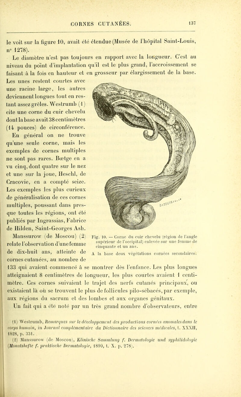 le voit sur la figure 10, avait été étendue (Musée de l'hôpital Saint-Louis, n 1278). Le diamètre n'est pas toujours en rapport avec la longueur. C'est au niveau du point d'implantation qu'il est le plus grand, l'accroissement se faisant à la fois en hauteur et en grosseur par élargissement de la base. Les unes restent courtes avec une racine largo, les autres deviennent longues tout en res- tant assez grêles. Westrumb (1 ) cite une corne du cuir chevelu dont la base avait 38 centimètres (14 pouces) de circonférence. En général on ne trouve qu'une seule corne, mais les exemples de cornes multiples ne sont pas rares. Bœtge en a vu cinq, dont quatre sur le nez et une sur la joue, Heschl, de Cracovie, en a compté seize. Les exemples les plus curieux de généralisation de ces cornes multiples, poussant dans pres- que toutes les régions, ont été publiés par Ligrassias, Fabrice de Hilden, Saint-Georges Ash. Manssurow (de Moscou) (2j relate l'observation d une femme de dix-huit ans, atteinte de cornes cutanées, au nombre de 133 qui avaient commencé à se montrer dès l'enfance. Les plus longues atteignaient 8 centimètres de longueur, les plus courtes avaient I centi- mètre. Ces cornes suivaient le trajet des nerfs cutanés principaux, ou existaient là où se trouvent le plus de follicules pilo-sébacés, par exemple, aux régions du sacrum et des lombes et aux organes génitaux. Un fait qui a été noté par un très grand nombre d'observateurs, entre Fig. 10. — Corne du cuir chevelu (région de l'augle supérieur de l'occipital) enlevée sur une femme de cinquante et un ans. A la base deux végétations cornées secondaires. (1) Weslrumb, Remarques sur le développement des productions cornées anomalesdans le corps humain, in Journal complémentaire du Dictionnaire des sciences médicales, t. XXXII, 1828, p. 331. (2) Manssurow (de Moscou), Klinische Sammlung f. Dermatolofjie und syphilidologîe {Monatshefle f. prakiische Dermatologie, 1890, t. X. p. 278).