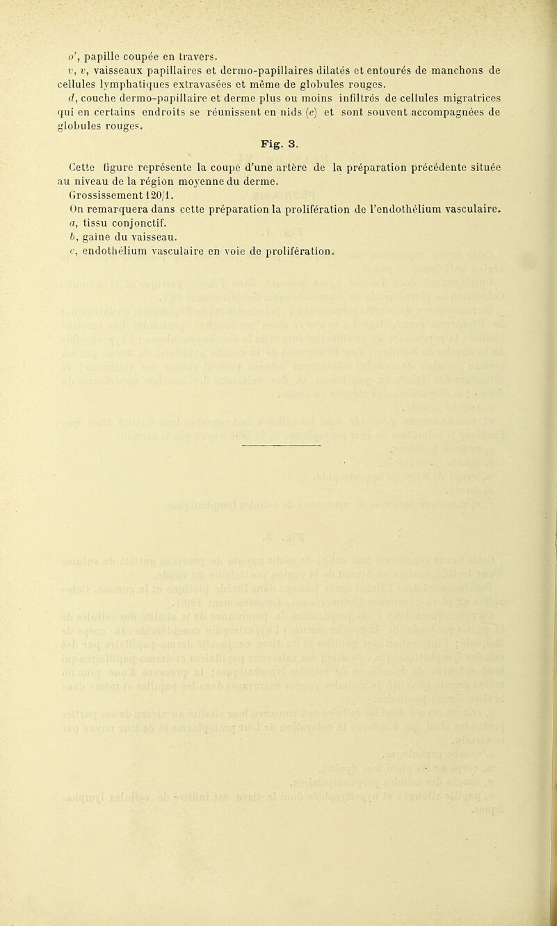 o', papille coupée en travers. V, V, vaisseaux papillaires et dermo-papiilaires dilatés et entourés de manchons de cellules lymphatiques extravasées et même de globules rouges. d, couche dermo-papillaire et derme plus ou moins infiltrés de cellules migratrices qui en certains endroits se réunissent en nids (e) et sont souvent accompagnées de globules rouges. Fig. 3. Cette figure représente la coupe d'une artère de la préparation précédente située au niveau de la région moyenne du derme. Grossissement 120/i. On remarquera dans cette préparation la prolifération de l'endothélium vasculaire. a, tissu conjonctif. 6, gaine du vaisseau. €, endothélium vasculaire en voie de prolifération.