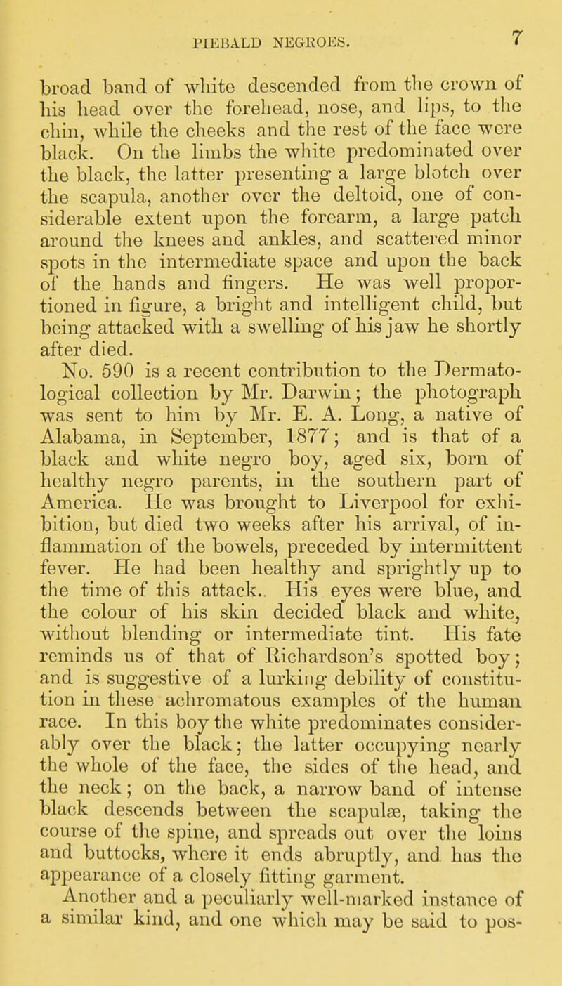 PIEBALD NEGROES. broad band of white descended from the crown of his head over the forehead, nose, and lips, to the chin, while the cheeks and the rest of the face were black. On the limbs the white i^redominated over the black, the latter presenting a large blotch over the scapula, another over the deltoid, one of con- siderable extent upon the forearm, a large patch around the knees and ankles, and scattered minor spots in the intermediate space and upon the back of the hands and fingers. He was well propor- tioned in figure, a bright and intelligent child, but being attacked with a swelling of his jaw he shortly after died. No. 590 is a recent contribution to the Dermato- logical collection by Mr. Darwin; the photograph was sent to him by Mr. E. A. Long, a native of Alabama, in September, 1877; and is that of a black and white negro boy, aged six, born of healthy negro parents, in the southern part of America. He was brought to Liverpool for exhi- bition, but died two weeks after his arrival, of in- flammation of the bowels, preceded by intermittent fever. Pie had been healthy and sprightly up to the time of this attack.. His eyes were blue, and the colour of his skin decided black and white, without blending or intermediate tint. His fate reminds us of that of Richardson's spotted boy; and is suggestive of a lurking debility of constitu- tion in these achromatous examples of the human race. In this boy the white predominates consider- ably over the black; the latter occupying nearly the whole of the face, the sides of the head, and the neck; on the back, a narrow band of intense black descends between the scapulae, taking the course of the spine, and spreads out over the loins and buttocks, where it ends abruptly, and has the appearance of a closely fitting garment. Another and a peculiarly well-marked instance of a similar kind, and one which may be said to pos-