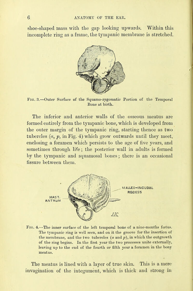 slioe-sliaped mass with the gap looking upwards. Within this incomplete ring as a frame, the tympanic membrane is stretched. Fia. 3.—Outer Surface of the Squamo-zygomatic Portion of the Temporal Bone at birth. The inferior and anterior walls of the osseous meatus are formed entirely from the tympanic bone, which is developed from the outer margin of the tympanic ring, starting thence as two tubercles («, p, in Fig. 4) which grow outwards until they meet, enclosing a foramen which persists to the age of five years, and sometimes through life; the posterior wall in adults is formed by the tympanic and squamosal bones; there is an occasional fissure between them. MAST. ANTRUM M ALLEO-INCUDAL RECESS Tig. 4.—The inner surface of the left temporal bone of a nine-months foetus. The tympanic ring is well seen, and on it the groove for the insertion of the membrane, and the two tubercles (a and in which the outgrowth of the ring begins. In the first year the two processes unite externallr, leaving up to the end of the fourth or fifth year a foramen in the bony meatus. The meatus is lined with a layer of true skin. This is a mere invagination of the integument, which is thick and strong in