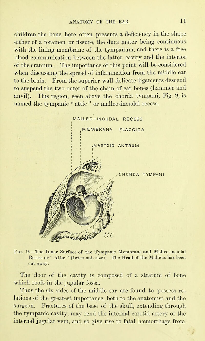 children the bone here often presents a deficiency in the shape either of a foramen or fissure, the dura mater being continuous with the lining membrane of the tympanum, and there is a free blood communication between the latter cavity and the interior of the cranium. The importance of this point will be considered when discussing the spread of inflammation from the middle ear to the brain. From the superior wall delicate ligaments descend to suspend the two outer of the chain of ear bones (hammer and anvil). This region, seen above the chorda tympani, Fig. 9, is named the tympanic  attic  or malleo-incudal recess. .MALLEO-INCUDAL RECESS i .MEMBRANA FLACCIDA ; i .MASTOID ANTRUM CHORDA TYMPANl Fig. 9.—The Inner Surface of the Tympanic Membrane and Malleo-incudal Kecess or Attic (twice nat. size). The Head of the Malleus has been cut away. The floor of the cavity is composed of a stratum of bone which roofs in the jugular fossa. Thus the six sides of the middle ear are found to possess re- lations of the greatest importance, botli to tlie anatomist atid the surgeon. Fractures of the base of the skull, extending through the tympanic cavity, may rend the internal carotid artery or the internal jugular vein, and so give rise to fatal ha3niorrhage from