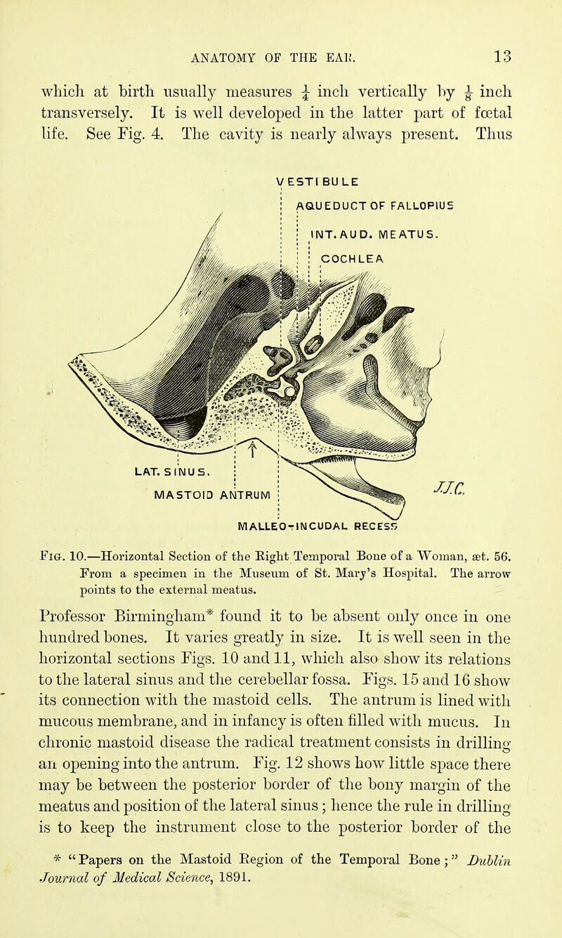 whicli at birtli usually measures ^ inch vertically hy g- inch transversely. It is well developed in the latter 'part of foetal life. See Fig. 4. The cavity is nearly always present. Thus VESTIBULE malleotincudal recess Fig. 10.—Horizontal Section of the Eight Temporal Bone of a Woman, set. 56. Prom a specimen in the Museum of St. Marj's Hospital. The arrow points to the external meatus. Professor Birmingham* found it to be absent only once in one hundred bones. It varies greatly in size. It is well seen in the horizontal sections Figs. 10 and 11, which also show its relations to the lateral sinus and the cerebellar fossa. Figs. 15 and 16 show its connection with the mastoid cells. The antrum is lined with mucous membrane, and in infancy is often filled with mucus. In chronic mastoid disease the radical treatment consists in drillins an opening into the antrum. Fig. 12 shows how little space there may be between the posterior border of the bony margin of the meatus and position of the lateral siims ; hence the rule in drilling is to keep the instrument close to the posterior border of the *  Papers on the Mastoid Eegion of the Temporal Bone; Dublin Journal of Medical Science, 1891.