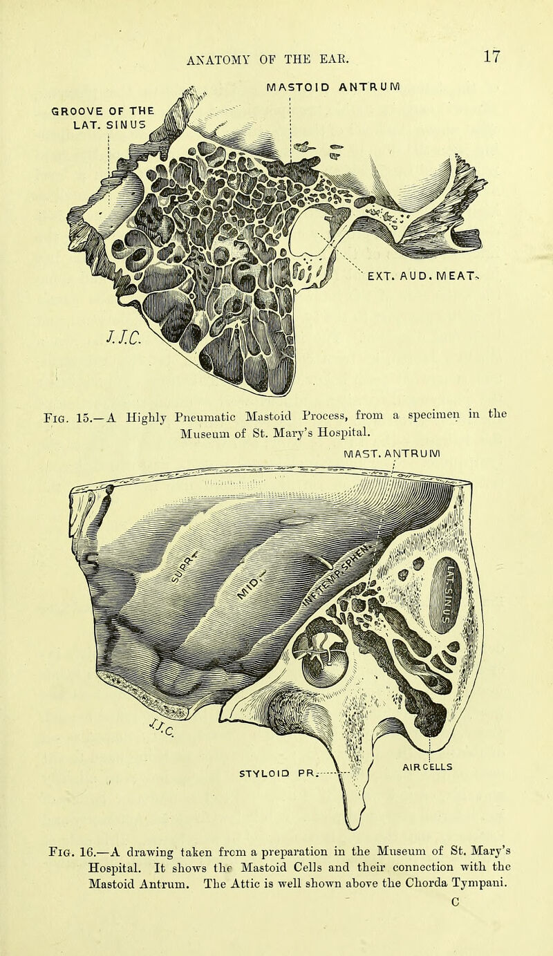 Fig. 16.—a drawing taken from a preparation in the Museum of St. Mary's Hospital. It shows tlir Mastoid Cells and their connection with the Mastoid Antrum. The Attic is well shown above the Chorda Tynipani. C