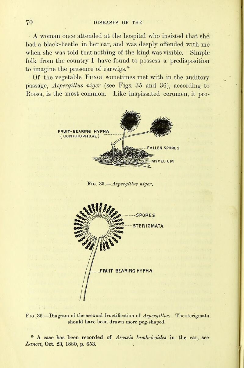 A woman once attended at the hospital wlio insisted that she had a black-beetle in her ear, and was deeply offended with me when she was told that nothing of the kind was visible. Simple folk from the country I have found to possess a predisposition to imagine the presence of earwigs.* Of the vegetable Fungi sometimes met with in the auditory passage, Aspergillus niger (see Figs. 35 and 36), according to Eoosa, is the most common. Like inspissated cerumen, it pro- FiG. 35.—Aspergillus niger. Fig. 36.—Diagram of the asexual fructification of Aspergillus. The sterigmata should have been drawn more peg-shaped. * A case has been recorded of Ascaris hcmbricoides in the ear, see Zancet, Oct. 23, 1880, p. 653,