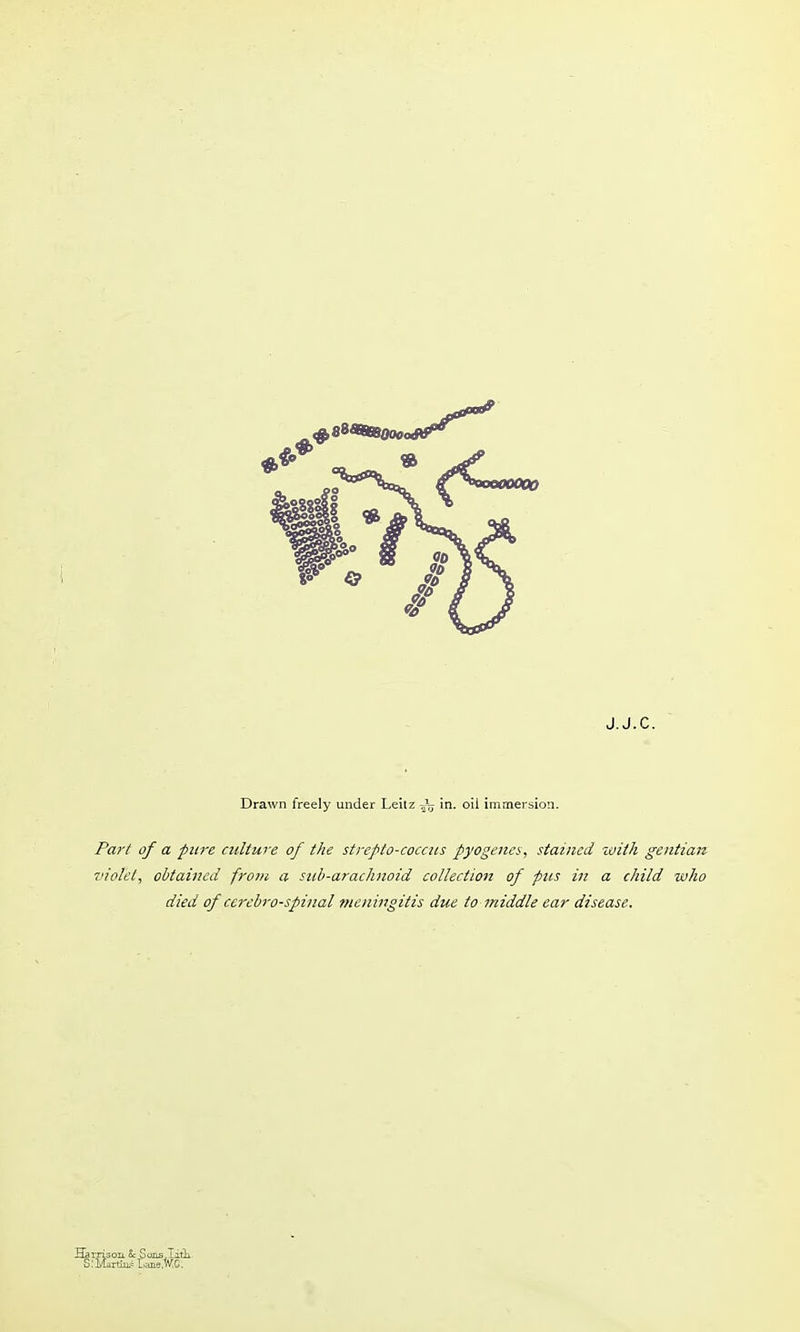 Drawn freely under Leitz ^^r; in. oil immersion. Pa?-/ of a pure culture of the strepto-coccics pyogena, stained with gentian violet, obtained from a sub-arachnoid collectioji of pus in a child zvho died of cerebrospinal fneningitis due to middle ear disease.