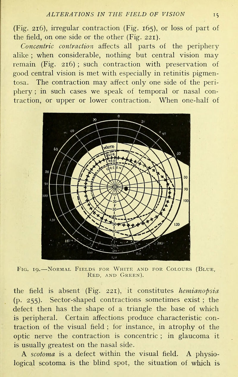 (Fig. 2i6), irregular contraction (Fig. 165), or loss of part of the field, on one side or the other (Fig. 221). Concentric contraction affects all parts of the periphery alike ; when considerable, nothing but central vision may remain (Fig. 216) ; such contraction with preservation of good central vision is met with especially in retinitis pigmen- tosa. The contraction may affect only one side of the peri- phery ; in such cases we speak of temporal or nasal con- traction, or upper or lower contraction. When one-half of Fig. 19.—Normal Fields for White and for Colours (Blue, Red, and Green). the field is absent (Fig. 221), it constitutes hemianopsia (p. 255). Sector-shaped contractions sometimes exist ; the defect then has the shape of a triangle the base of which is peripheral. Certain affections produce characteristic con- traction of the visual field ; for instance, in atrophy of the optic nerve the contraction is concentric ; in glaucoma it is usually greatest on the nasal side. A scotoma is a defect within the visual field. A physio- logical scotoma is the blind spot, the situation of which is