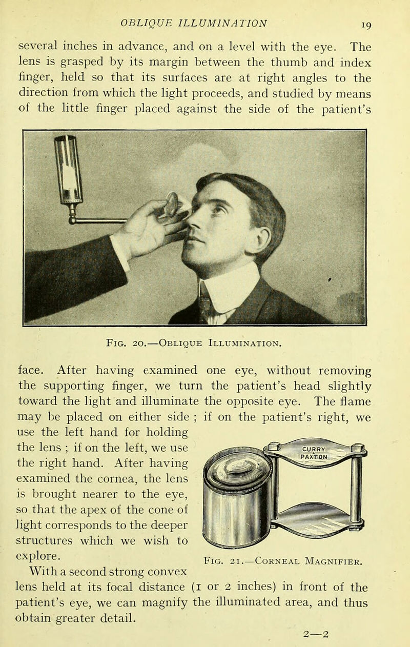 OBLIQUE ILLUMINATION several inches in advance, and on a level with the eye. The lens is grasped by its margin between the thumb and index finger, held so that its surfaces are at right angles to the direction from which the light proceeds, and studied by means of the little finger placed against the side of the patient's Fig. 20.—Oblique Illumination. face. After having examined one eye, without removing the supporting finger, we turn the patient's head slightly toward the light and illuminate the opposite eye. The flame may be placed on either side ; if on the patient's right, we use the left hand for holding the lens ; if on the left, we use the right hand. After having examined the cornea, the lens is brought nearer to the eye, so that the apex of the cone of light corresponds to the deeper structures which we wish to explore. With a second strong convex lens held at its focal distance (i or 2 inches) in front of the patient's eye, we can magnify the illuminated area, and thus obtain greater detail. 2—2 Fig. 21.—Corneal Magnifier.