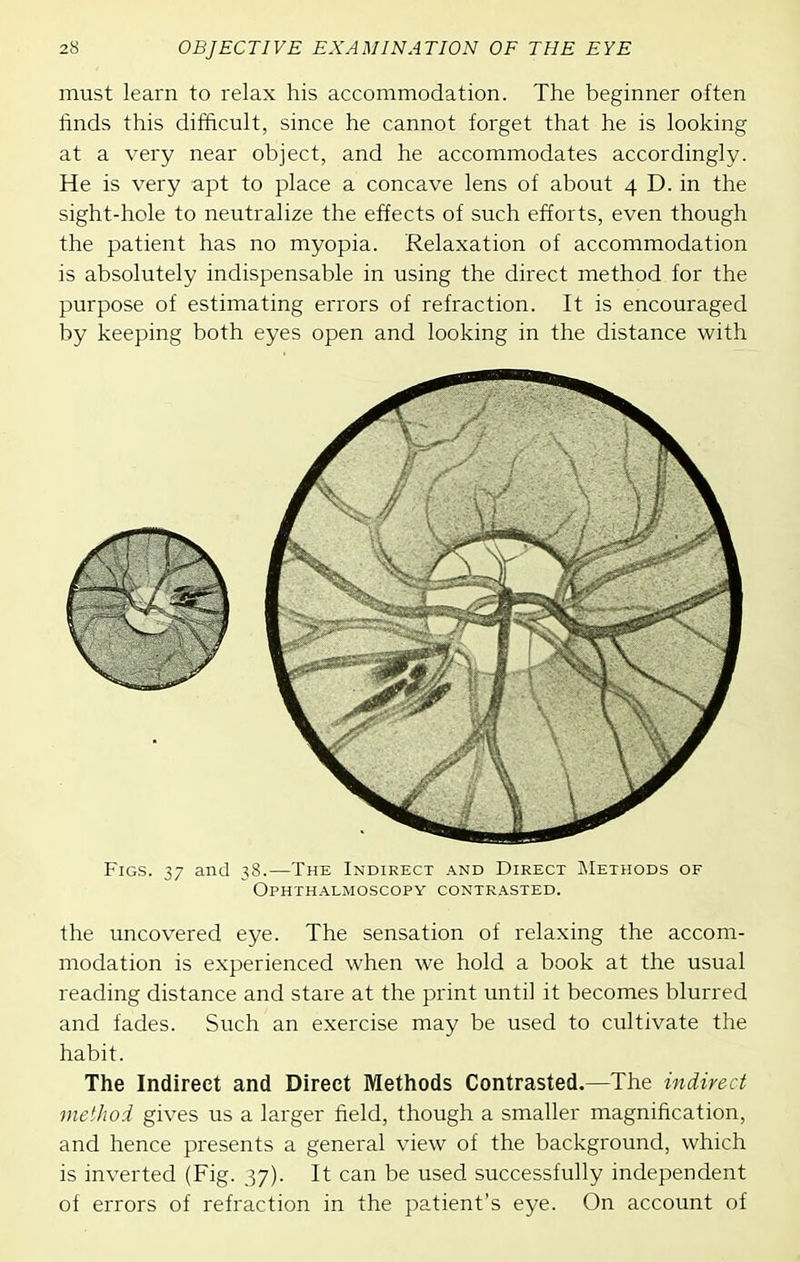 must learn to relax his accommodation. The beginner often finds this difficult, since he cannot forget that he is looking at a very near object, and he accommodates accordingly. He is very apt to place a concave lens of about 4 D. in the sight-hole to neutralize the effects of such efforts, even though the patient has no myopia. Relaxation of accommodation is absolutely indispensable in using the direct method for the purpose of estimating errors of refraction. It is encouraged by keeping both eyes open and looking in the distance with Figs. 37 and 38.—The Indirect and Direct INIethods of Ophthalmoscopy contrasted. the uncovered eye. The sensation of relaxing the accom- modation is experienced when we hold a book at the usual reading distance and stare at the print until it becomes blurred and fades. Such an exercise may be used to cultivate the habit. The Indirect and Direct Methods Contrasted.—The indirect method gives us a larger field, though a smaller magnification, and hence presents a general view of the background, which is inverted (Fig. 37). It can be used successfully independent of errors of refraction in the patient's eye. On account of