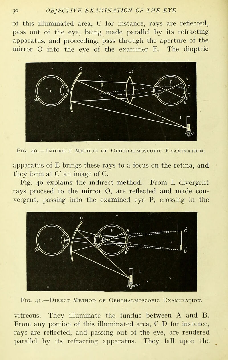 of this illuminated area, C for instance, rays are reflected, pass out of the eye, being made parallel by its refracting apparatus, and proceeding, pass through the aperture of the mirror O into the eye of the examiner E. The dioptric Fig. 40.—Indirect Method of Ophthalmoscopic Examination. apparatus of E brings these rays to a focus on the retina, and they form at C an image of C. Fig. 40 explains the indirect method. From L divergent rays proceed to the mirror O, are reflected and made con- vergent, passing into the examined eye P, crossing in the Fig. 41.—Direct Method of Ophthalmoscopic Examination. vitreous. They illuminate the fundus between A and B. From any portion of this illuminated area, C D for instance, rays are reflected, and passing out of the eye, are rendered parallel by its refracting apparatus. They fall upon the