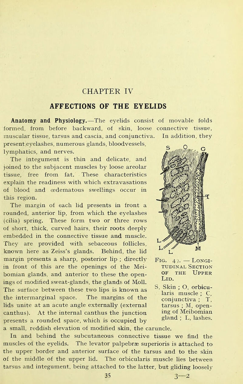 CHAPTER IV AFFECTIONS OF THE EYELIDS Anatomy and Physiology.—The eyelids consist of movable folds formed, from before backward, of skin, loose connective tissue, muscular tissue, tarsus and cascia, and conjunctiva. In addition, they present,eyelashes, numerous glands, bloodvessels, lymphatics, and nerves. The integument is thin and delicate, and joined to the subjacent muscles by loose areolar tissue, free from fat. These characteristics explain the readiness with which extravasations of blood and oedematous swellings occur in this region. The margin of each lid presents in front a rounded, anterior lip, from which the eyelashes (cilia) spring. These form two or three rows of short, thick, curved hairs, their roots deeply embedded in the connective tissue and muscle. They are provided with sebaceous follicles, known here as Zeiss's glands. Behind, the lid margin presents a sharp, posterior lip ; directly in front of this are the openings of the Mei- bomian glands, and anterior to these the open- ings of modified sweat-glands, the glands of Moll. The surface between these two lips is known as the intermarginal space. The margins of the lids unite at an acute angle externally (external canthus). At the internal canthus the junction presents a rounded space, which is occupied by a small, reddish elevation of modified skin, the caruncle. In and behind the subcutaneous connective tissue we find the muscles of the eyelids. The levator palpebrse superioris is attached to the upper border and anterior surface of the tarsus and to the skin of the middle of the upper lid. The orbicularis muscle lies between tarsus and integument, being attached to the latter, but gliding loosely 3S 3—2 Fig. 4). — Longi- tudinal Section OF THE Upper Lid. S, Skin ; O, orbicu- laris muscle ; C, conjunctiva ; T, tarsus ; M, open- ing of Meibomian gland ; L, lashes.