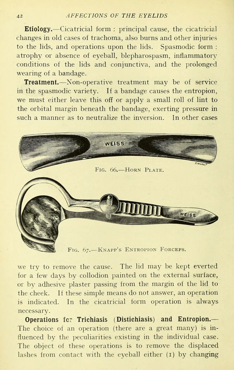 Etiology.—Cicatricial form : principal cause, the cicatricial changes in old cases of trachoma, also burns and other injuries to the lids, and operations upon the lids. Spasmodic form : atrophy or absence of eyeball, blepharospasm, inflammatory conditions of the lids and conjunctiva, and the prolonged wearing of a bandage. Treatment.—Non-operative treatment may be of service in the spasmodic variety. If a bandage causes the entropion, we must either leave this off or apply a small roll of lint to the orbital margin beneath the bandage, exerting pressure in such a manner as to neutralize the inversion. In other cases we try to remove the cause. The lid may be kept everted for a few days by collodion painted on the external surface, or by adhesive plaster passing from the margin of the lid to the cheek. If these simple means do not answer, an operation is indicated. In the cicatricial form operation is always necessary. Operations for Trichiasis (Distichiasis) and Entropion.— The choice of an operation (there are a great many) is in- fluenced by the peculiarities existing in the individual case. The object of these operations is to remove the displaced lashes from contact with the eyeball either (i) by changing