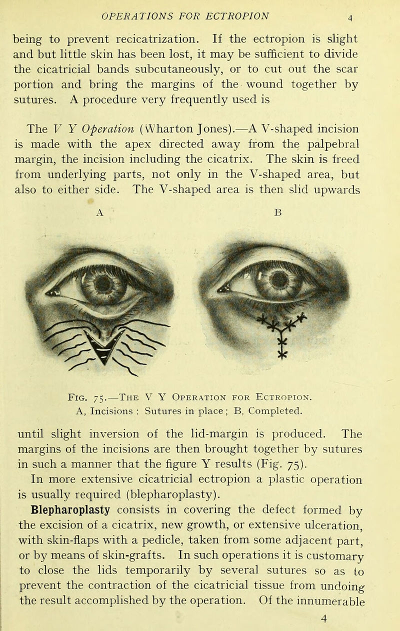 being to prevent recicatrization. If the ectropion is slight and but little skin has been lost, it may be sufficient to divide the cicatricial bands subcutaneously, or to cut out the scar portion and bring the margins of the wound together by sutures. A procedure very frequently used is The V Y Operation (Wharton Jones).—A V-shaped incision is made with the apex directed away from the palpebral margin, the incision including the cicatrix. The skin is freed from underlying parts, not only in the V-shaped area, but also to either side. The V-shaped area is then slid upwards A B Fig. 75.—The V Y Operation for Ectropion. A, Incisions : Sutures in place; B, Completed. until slight inversion of the lid-margin is produced. The margins of the incisions are then brought together by sutures in such a manner that the figure Y results (Fig. 75). In more extensive cicatricial ectropion a plastic operation is usually required (blepharoplasty). Blepharoplasty consists in covering the defect formed by the excision of a cicatrix, new growth, or extensive ulceration, with skin-flaps with a pedicle, taken from some adjacent part, or by means of skin-grafts. In such operations it is customary to close the lids temporarily by several sutures so as to prevent the contraction of the cicatricial tissue from undoing the result accomplished by the operation. Of the innumerable 4