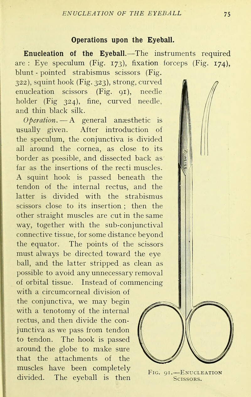 Operations upon the Eyeball. Enucleation of the Eyeball.—^The instruments required are : Eye speculum (Fig. 173), fixation forceps (Fig. 174), blunt - pointed strabismus scissors (Fig. 322), squint hook (Fig. 323), strong, curved enucleation scissors (Fig. gi), needle holder (Fig 324), fine, curved needle, and thin black silk. Operation. — A general anaesthetic is usually given. After introduction of the speculum, the conjunctiva is divided all around the cornea, as close to its border as possible, and dissected back as far as the insertions of the recti muscles. A squint hook is passed beneath the tendon of the internal rectus, and the latter is divided with the strabismus scissors close to its insertion ; then the other straight muscles are cut in the same way, together with the sub-conjunctival connective tissue, for some distance beyond the equator. The points of the scissors must always be directed toward the eye ball, and the latter stripped as clean as possible to avoid any unnecessary removal of orbital tissue. Instead of commencing with a circumcorneal division of the conjunctiva, we may begin with a tenotomy of the internal rectus, and then divide the con- junctiva as we pass from tendon to tendon. The hook is passed around the globe to make sure that the attachments of the muscles have been completely „ ^ ^ Fig. 91.—Enucleation divided. The eyeball is then Scissors.