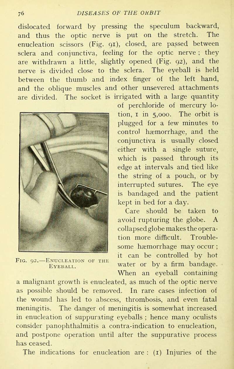 dislocated forward by pressing the speculum backward, and thus the optic nerve is put on the stretch. The enucleation scissors (Fig. 91), closed, are passed between sclera and conjunctiva, feeling for the optic nerve ; they are withdrawn a little, slightly opened (Fig. 92), and the nerve is divided close to the sclera. The eyeball is held between the thumb and index finger of the left hand, and the oblique muscles and other unsevered attachments are divided. The socket is irrigated with a large quantity a malignant growth is enucleated, as much of the optic nerve as possible should be removed. In rare cases infection of the wound has led to abscess, thrombosis, and even fatal meningitis. The danger of meningitis is somewhat increased in enucleation of suppurating eyeballs ; hence many ocialists consider panophthalmitis a contra-indication to enucleation, and postpone operation until after the suppurative process has ceased. The indications for enucleation are : (i) Injuries of the of perchloride of mercury lo- tion, I in 5,000. The orbit is plugged for a few minutes to control haemorrhage, and the conjunctiva is usually closed either with a single suture, which is passed through its edge at intervals and tied like the string of a pouch, or by interrupted sutures. The eye is bandaged and the patient kept in bed for a day. Fig. 92.—Enucleation of the Eyeball. Care should be taken to avoid rupturing the globe. A collapsed globe makes the opera- tion more difficult. Trouble- some haemorrhage may occur; it can be controlled by hot water or by a firm bandage. When an eyeball containing
