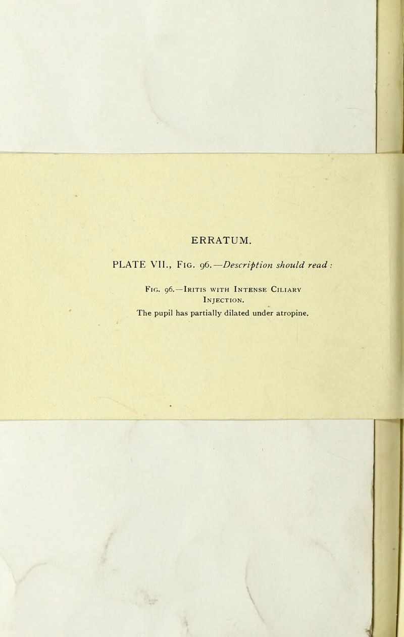 ERRATUM. PLATE VII., Fig. g6.—Description should read Fig. 96.—Iritis with Intense Ciliary Injection. The pupil has partially dilated under atropine. \ \
