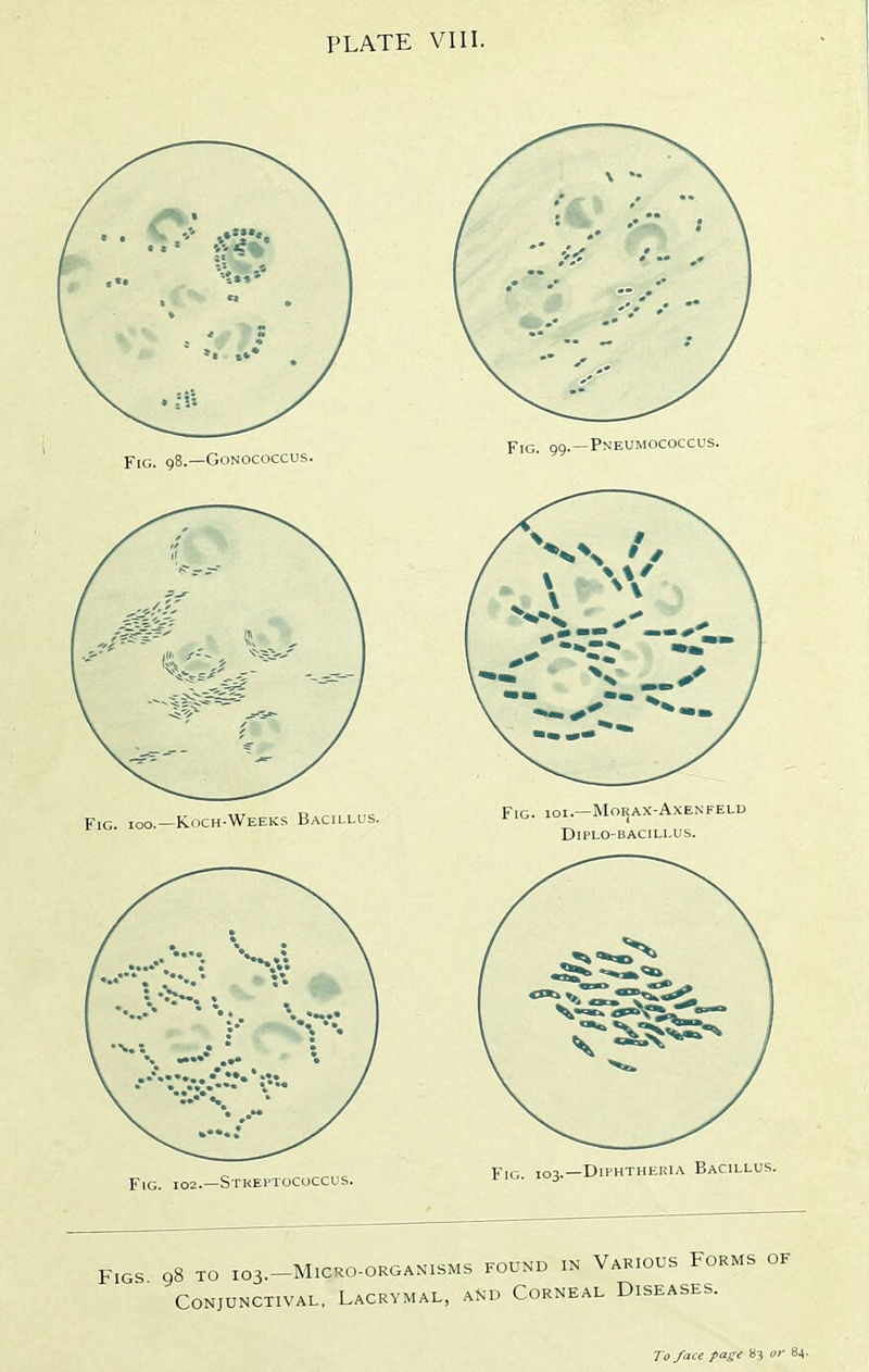 Figs 98 to 103.-M1CR0-ORGANISMS found in Various Forms of Conjunctival, Lacrymal, and Corneal Diseases.