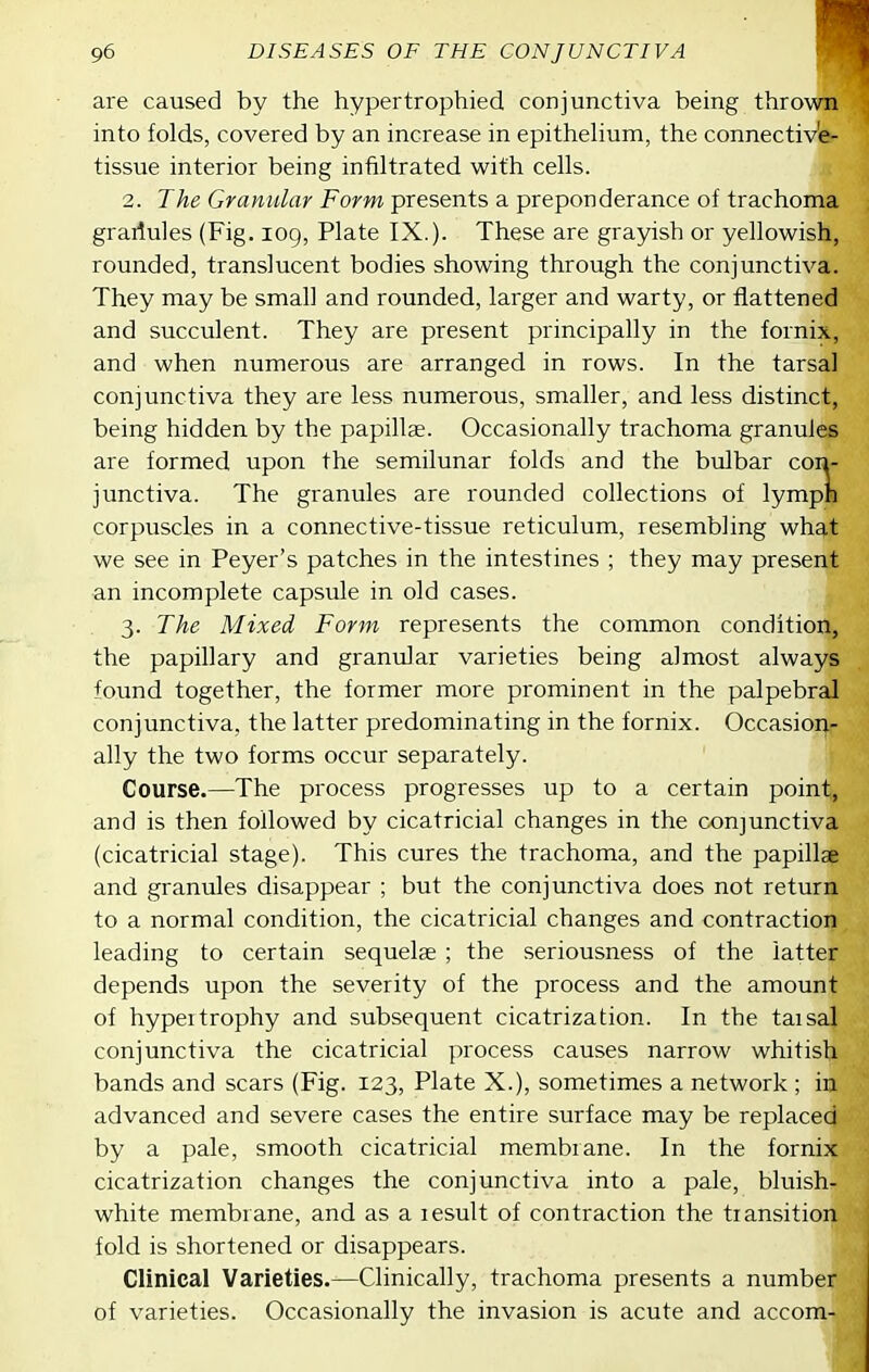 are caused by the hypertrophied conjunctiva being thrown into folds, covered by an increase in epithelium, the connective- tissue interior being infiltrated with cells. 2. The Granular Form presents a preponderance of trachoma grarlules (Fig. 109, Plate IX.). These are grayish or yellowish, rounded, translucent bodies showing through the conjunctiva. They may be small and rounded, larger and warty, or flattened and succulent. They are present principally in the fornix, and when numerous are arranged in rows. In the tarsal conjunctiva they are less numerous, smaller, and less distinct, being hidden by the papillae. Occasionally trachoma granules are formed upon the semilunar folds and the bulbar con- junctiva. The granules are rounded collections of lymph corpuscles in a connective-tissue reticulum, resembling whg,t we see in Peyer's patches in the intestines ; they may present an incomplete capsule in old cases. 3. The Mixed Form represents the common condition, the papillary and granular varieties being almost always found together, the former more prominent in the palpebral conjunctiva, the latter predominating in the fornix. Occasion- ally the two forms occur separately. Course.—The process progresses up to a certain point, and is then followed by cicatricial changes in the conjunctiva (cicatricial stage). This cures the trachoma, and the papillae and granules disappear ; but the conjunctiva does not return to a normal condition, the cicatricial changes and contraction leading to certain sequelae ; the seriousness of the latter depends upon the severity of the process and the amount of hypertrophy and subsequent cicatrization. In the taisal conjunctiva the cicatricial process causes narrow whitish bands and scars (Fig. 123, Plate X.), sometimes a network ; in advanced and severe cases the entire surface may be replaced by a pale, smooth cicatricial membrane. In the fornix cicatrization changes the conjunctiva into a pale, bluish- white membrane, and as a lesult of contraction the transition fold is shortened or disappears. Clinical Varieties.—Clinically, trachoma presents a number of varieties. Occasionally the invasion is acute and accom-