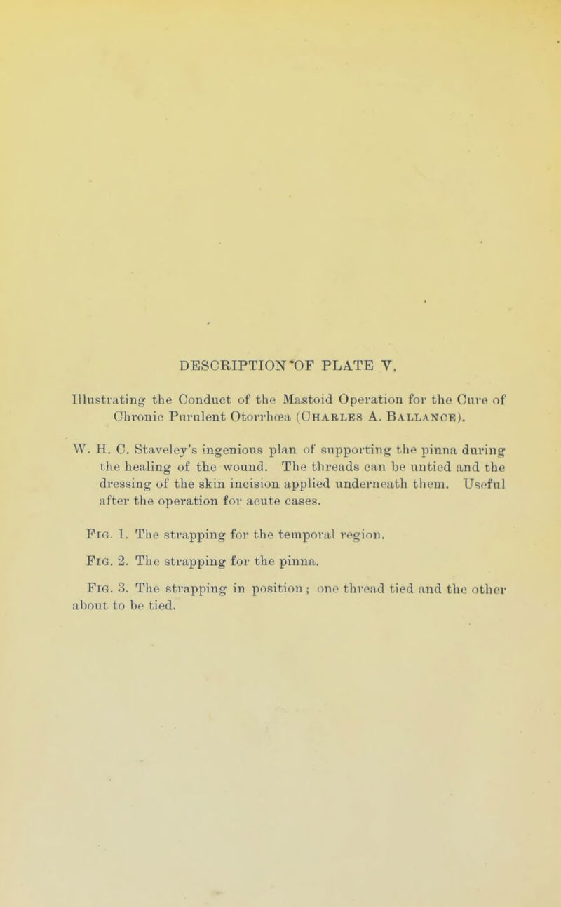 DESCRIPTION-OF PLATE V, Illustrating the Conduct of the Mastoid Opei'ation for the Cure of Chronic Purulent Otorrhcea (Charles A. Ballance). W. H. C. Staveley's ingenious plan of suppoi'ting the pinna during the healing of the wound. The threads can be untied and the dressing of the skin incision applied underneath them. Useful after the operation for acute cases. Fin. 1. The strapping for the temporal region. Fig. 2. Th(! strapping for the pinna. Fig. 3. The strapping in position ; ono thread tied and the other about to be tied.