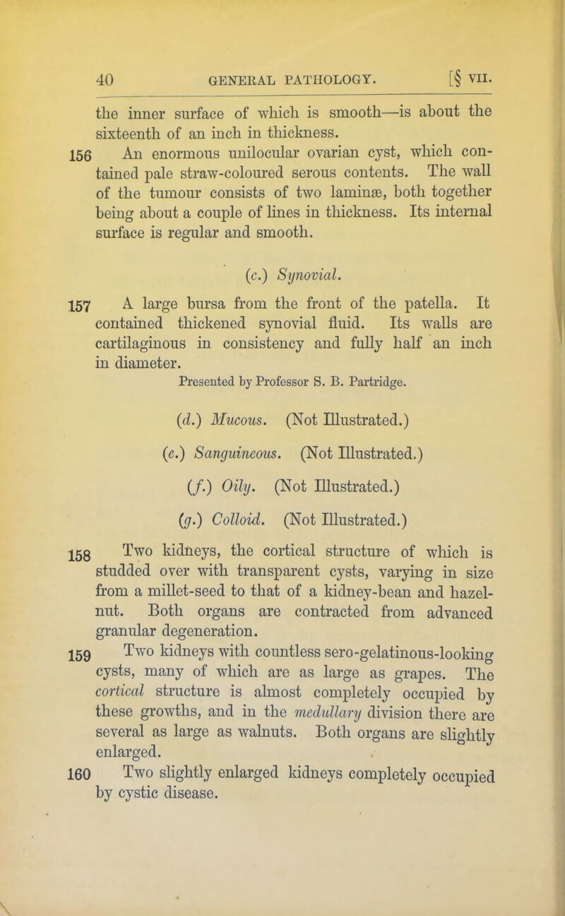 the inner surface of which is smooth—is about the sixteenth of an inch in thickness. 156 An enormous unilocular ovarian cyst, which con- tained pale straw-coloured serous contents. The wall of the tumour consists of two laminae, both together being about a couple of lines in thickness. Its internal sui'face is regular and smooth. (c.) Synovial. 157 A large bursa from the front of the patella. It contained thickened synovial fluid. Its walls are cartilaginous in consistency and fully half an inch in diameter. Presented by Professor S. B. Partridge. (d.) Mucous. (Not Illustrated.) (e.) Sanguineous. (Not Illustrated.) (/.) Oily. (Not Illustrated.) {g.) Colloid. (Not Illustrated.) j^5g Two kidneys, the cortical structure of which is studded over with transparent cysts, varying in size from a millet-seed to that of a kidney-bean and hazel- nut. Both organs are contracted from advanced granular degeneration. ^59 Two kidneys with countless sero-gelatinous-looking cysts, many of which are as large as grapes. The cortical structure is almost completely occupied by these growths, and in the medullary division there are several as large as walnuts. Both organs are slightly enlarged. 160 Two sHghtly enlarged kidneys completely occupied by cystic disease.