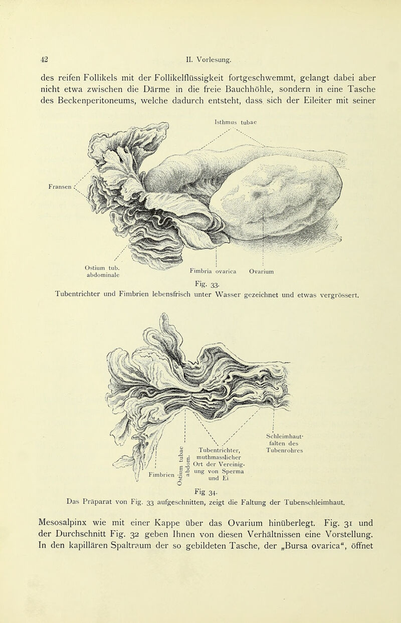 des reifen Follikels mit der Follikelflüssigkeit fortgeschwemmt, gelangt dabei aber nicht etwa zwischen die Därme in die freie Bauchhöhle, sondern in eine Tasche des Beckenperitoneums, welche dadurch entsteht, dass sich der Eileiter mit seiner Fransen ,n Fig- 33- Tubentrichter und Fimbrien lebensfrisch unter Wasser gezeichnet und etwas vergrössert. Fig 34- Das Präparat von Fig. 33 aufgeschnitten, zeigt die Faltung der Tubenschleimhaut. Mesosalpinx wie mit einer Kappe über das Ovarium hinüberlegt. Fig. 31 und der Durchschnitt Fig. 32 geben Ihnen von diesen Verhältnissen eine Vorstellung. In den kapillären Spaltraum der so gebildeten Tasche, der „Bursa ovarica, öffnet
