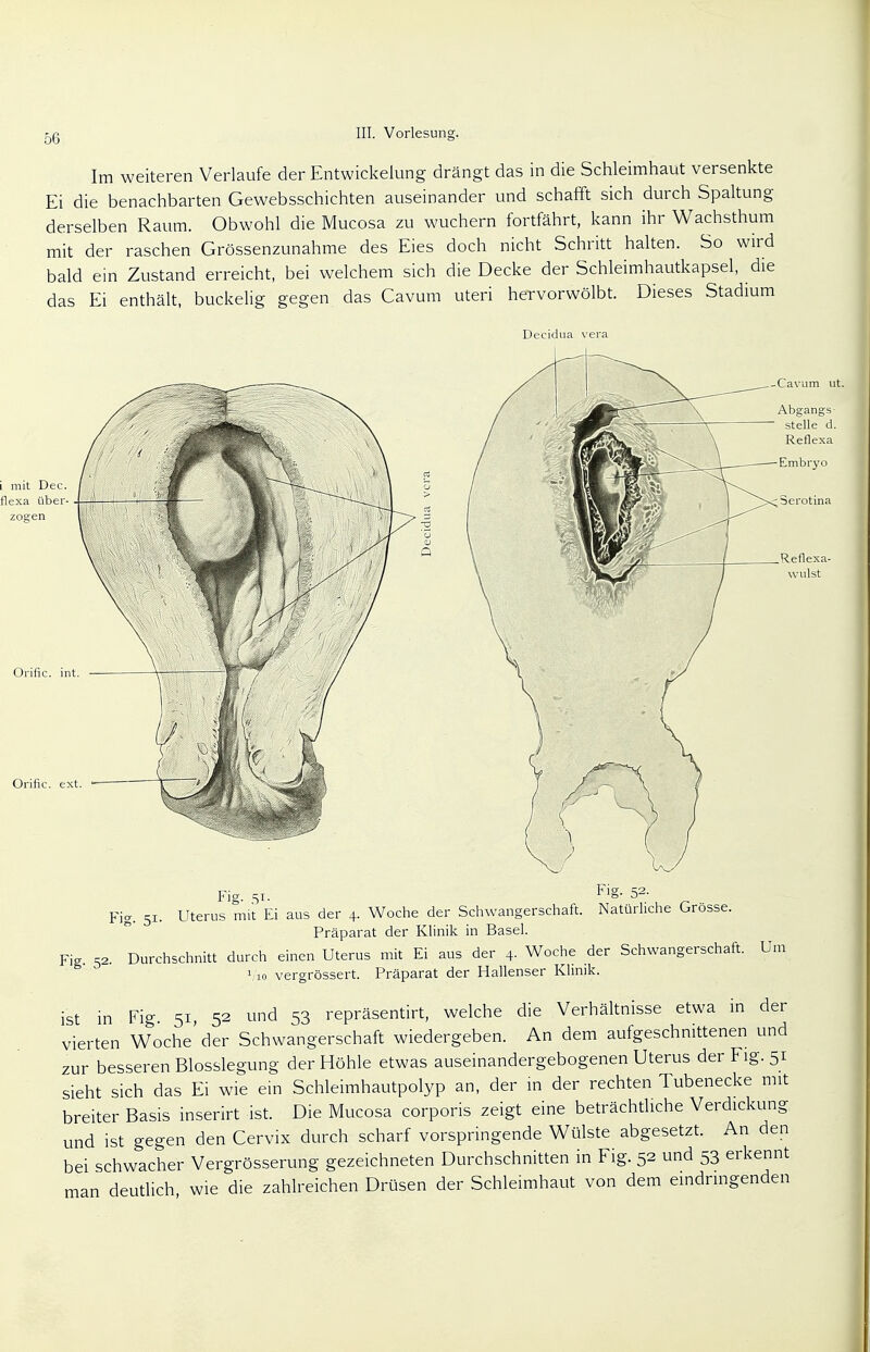 Im weiteren Verlaufe der Entwicklung drängt das in die Schleimhaut versenkte Ei die benachbarten Gewebsschichten auseinander und schafft sich durch Spaltung derselben Raum. Obwohl die Mucosa zu wuchern fortfährt, kann ihr Wachsthum mit der raschen Grössenzunahme des Eies doch nicht Schritt halten. So wird bald ein Zustand erreicht, bei welchem sich die Decke der Schleimhautkapsel, die das Ei enthält, buckelig gegen das Cavum uteri hervorwölbt. Dieses Stadium Decidua vera -Cavum ut. Reflexa- wulst Orific. int Orific. ext. Fig. 51. Fi§- 52- Fig. 51. Uterus mit Ei aus der 4. Woche der Schwangerschaft. Natürliche Grösse. Präparat der Klinik in Basel. Fig. 52. Durchschnitt durch einen Uterus mit Ei aus der 4. Woche der Schwangerschaft. Um V10 vergrössert. Präparat der Hallenser Klinik. ist in Fig 51, 52 und 53 repräsentirt, welche die Verhältnisse etwa in der vierten Woche'der Schwangerschaft wiedergeben. An dem aufgeschnittenen und zur besseren Blosslegung der Höhle etwas auseinandergebogenen Uterus der Fig. 51 sieht sich das Ei wie ein Schleimhautpolyp an, der in der rechten Tubenecke mit breiter Basis inserirt ist. Die Mucosa corporis zeigt eine beträchtliche Verdickung und ist gegen den Cervix durch scharf vorspringende Wülste abgesetzt. An den bei schwacher Vergrösserung gezeichneten Durchschnitten in Fig. 52 und 53 erkennt man deutlich wie die zahlreichen Drüsen der Schleimhaut von dem eindringenden
