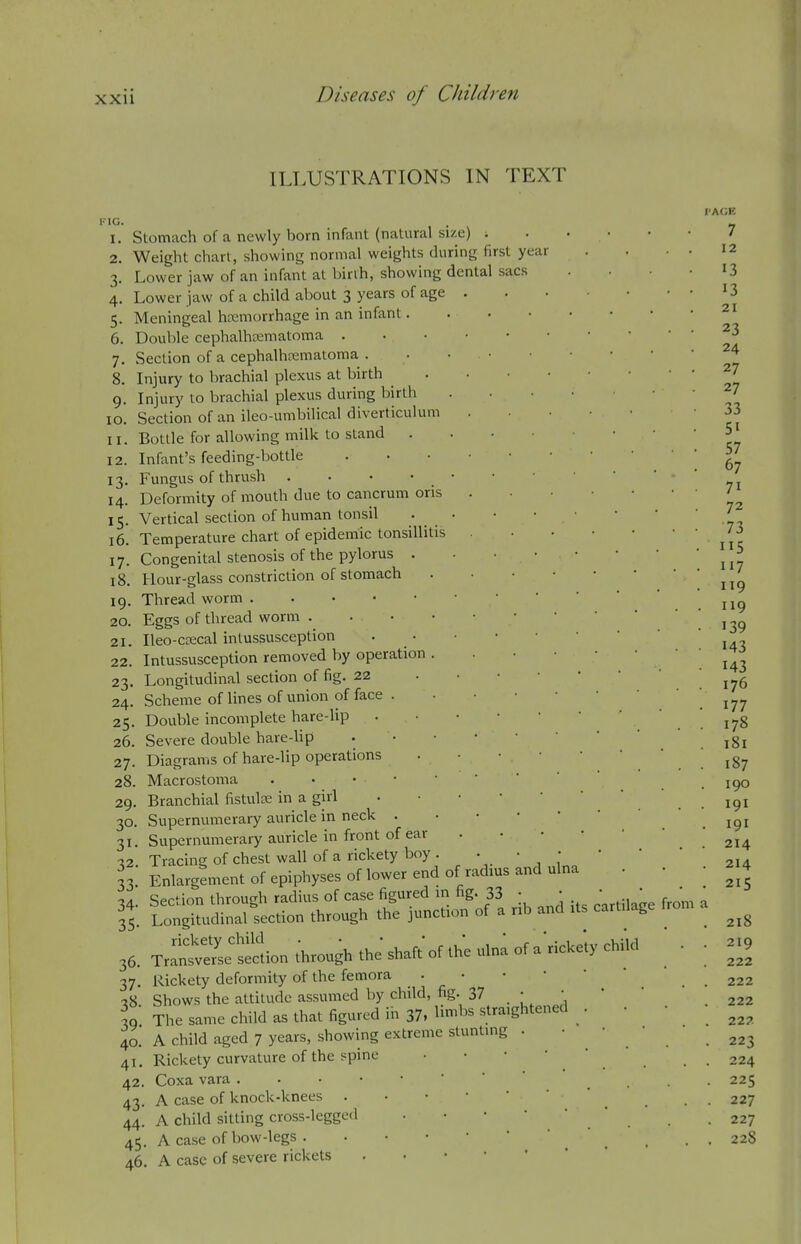 TT.LUSTRATIONS IN TEXT KIG. I. 2. 3- 4- 5- 6. 7. 8. 9- lO. II. 12. 13- 14. IS- 16. 17. 18. 19. 20. 21. 22. 23- 24. 25- 26. 27. 28. 29. 30- 31- 32- 33- 34- 35- 36. 37- 3«- 39- 40. 41. 42, 43' 44. 45 46 Stomach of a newly born infant (natural si/,e) ; Weight chart, showing normal weights during first year Lower jaw of an infant at binh, showing dental sacs Lower jaw of a child about 3 years of age . Meningeal hemorrhage in an infant. Double cephalhematoma . . . • Section of a cephalhematoma . Injury to brachial plexus at birth Injury to brachial plexus during birth Section of an ileo-umbilical diverticulum Bottle for allowing milk to stand Infant's feeding-bottle . . • • Fungus of thrush . • • • • Deformity of mouth due to cancrum oris Vertical section of human tonsil • _ • Temperature chart of epidemic tonsillitis Congenital stenosis of the pylorus . Hour-glass constriction of stomach Thread worm Eggs of thread worm Ileo-cecal intussusception . • Intussusception removed by operation . Longitudinal section of fig. 22 Scheme of lines of union of face . Double incomplete hare-lip Severe double hare-lip . • Diagrams of hare-lip operations Macrostoma Branchial fistule in a girl Supernumerary auricle in neck . Supernumerary auricle in front of ear Tracing of chest wall of a rickety boy . • Enlargement of epiphyses of lower end of radius and ulna Section through radius of case figured m fig. 33 • ; Longitudinal section through the junction of a nb and its cartilage Trrnsver'se section through the' shaft' of the uln^ of a'ricke'ty chiW Rickety deformity of the femora . • • • * Shows the attitude assumed by child, fig. 37 • • The same child as that figured in 37, limits straightened . • A child aged 7 years, showing extreme stuntmg . • • • Rickety curvature of the spine Coxa vara A case of knock-knees A child sitting cross-legged A case of bow-legs A case of severe rickets I-AGE 7 from a 12 13 13 21 23 24 27 27 33 51 57 67 71 72 73 115 117 119 119 139 143 143 176 177 178 181 187 190 191 191 214 214 215 218 219 222 222 222 222 223 224 225 227 227 228