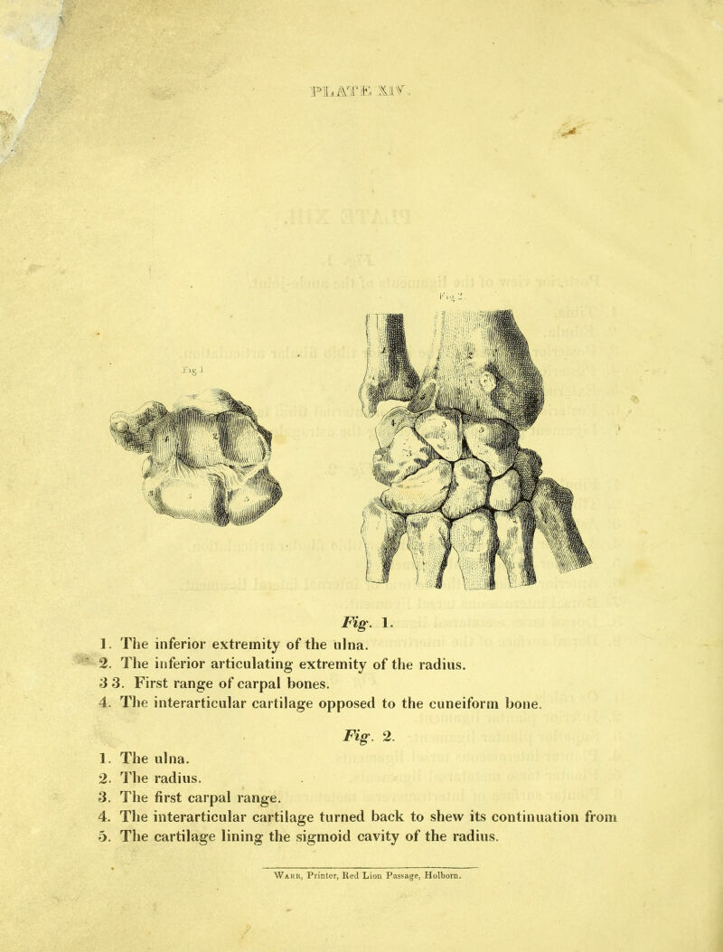 M. ATE Mf -, I'i./.i'. Fig. 1. 1. The inferior extremity of the ulna. 2. The inferior articulating extremity of the radius. 3 3. First range of carpal bones. 4. The interarticular cartilage opposed to the cuneiform bone. Fig. 2. 1. The ulna. 2. The radius. 3. The first carpal range. 4. The interarticular cartilage turned back to shew its continuation from 5. The cartilage lining the sigmoid cavity of the radius. Wakr, Printer, Red Lion Passage, Holborn.