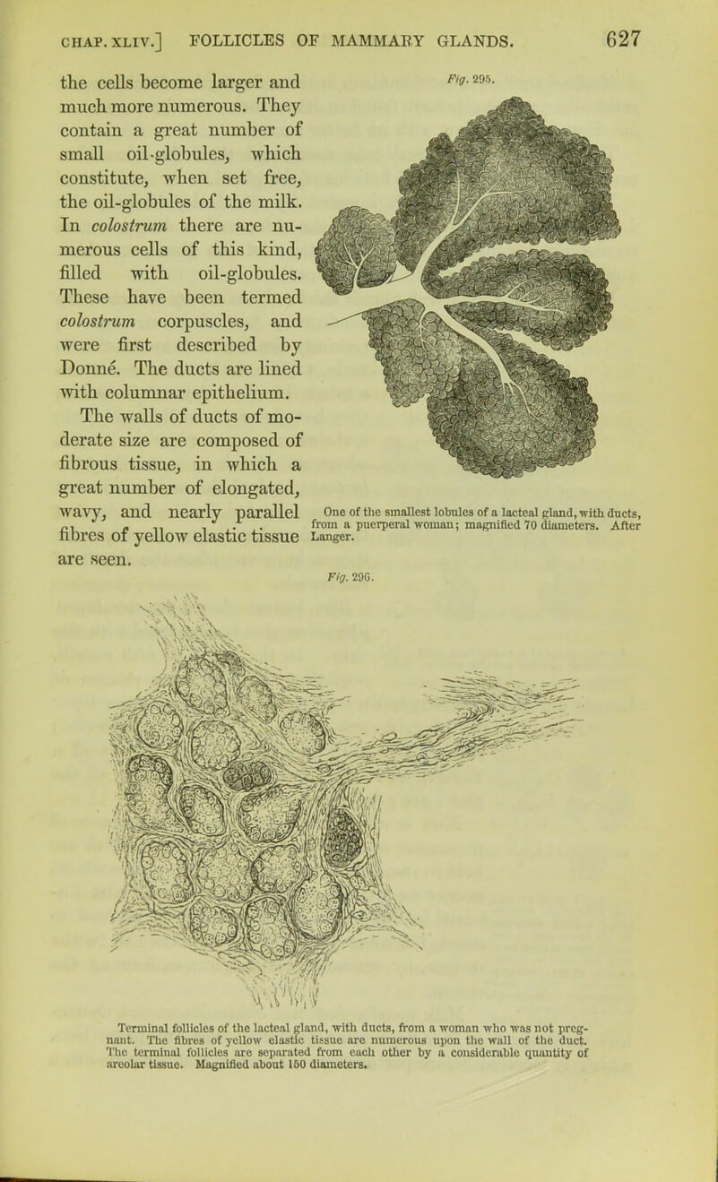 the cells become larger and ^'f• ^fs- much more numerous. They contain a great number of small oil-globuleSj which constitute, Avhen set free, the oil-globules of the milk. In colostrum there are nu- merous cells of this kind, filled with oil-globules. These have been termed colostrum corpuscles, and were first described by Donne. The ducts are lined with columnar epithelium. The walls of ducts of mo- derate size are composed of fibrous tissue, in which a great number of elongated, wavy, and nearly parallel one of tUe smallest lobnles of a lactealgland, with ducts, J,, - 1 • from a puci-peial woman; magnified 70 diameters. After fibres ot yellow elastic tissue Langer. are seen. Fig. 29C. Terminal follicles of the lacteal gland, vrA\\ dncts, from a woman who was not preg- nant. The fibres of yellow elastic tissue arc numerous upon the wall of the du(S. The terminal follicles are separated from each otlier by a considerable quantity of ni'colar tissue. Magnified about 160 diameters.