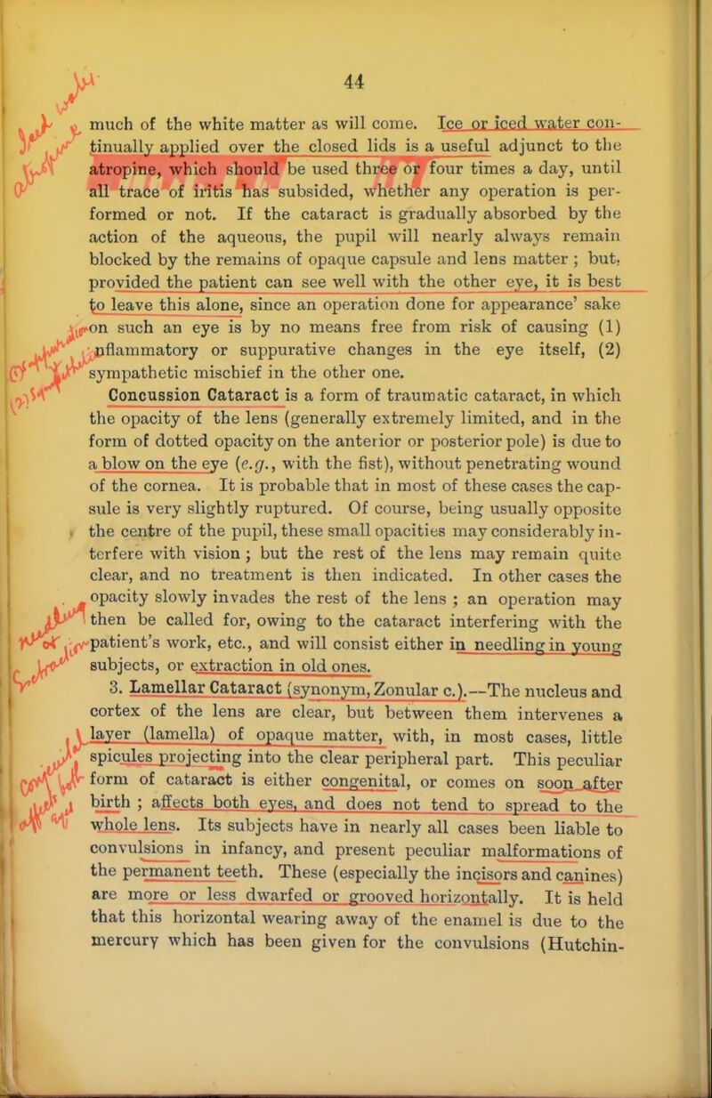 «. mu°h °f the white matter as will come. Ice or icerl water con- tinually applied over the closed lids is a useful adjunct to the atropine, which should be used three or four times a day, until all trace of iritis has subsided, whether any operation is per- formed or not. If the cataract is gradually absorbed by the action of the aqueous, the pupil will nearly always remain blocked by the remains of opaque capsule and lens matter ; but; provided the patient can see well with the other eye, it is best £o leave this alone, since an operation done for appearance' sake ^f-on such an eye is by no means free from risk of causing (1) JW^ inflammatory or suppurative changes in the eye itself, (2) i jL* sympathetic mischief in the other one. Concussion Cataract is a form of traumatic cataract, in which the opacity of the lens (generally extremely limited, and in the form of dotted opacity on the anterior or posterior pole) is due to a blow on the eye {e.g., with the fist), without penetrating wound of the cornea. It is probable that in most of these cases the cap- sule is very slightly ruptured. Of course, being usually opposite ■ the centre of the pupil, these small opacities may considerably in- terfere with vision ; but the rest of the lens may remain quite clear, and no treatment is then indicated. In other cases the . opacity slowly invades the rest of the lens ; an operation may Ar\ then be called for, owing to the cataract interfering with the ^wT inpatient's work, etc., and will consist either in needling in young J^<r subjects, or extraction in old ones. 3. Lamellar Cataract (synonym, Zonular a).—The nucleus and cortex of the lens are clear, but between them intervenes a V layer (lamella) of opaque matter, with, in most cases, little ^spiculeB projecting into the clear peripheral part. This peculiar (^fr-forni of cataract is either congenital, or comes on soojuaftej J? ^ birth ; affects both eyes, and does not tend to spread to the whole lens. Its subjects have in nearly all cases been liable to convulsions in infancy, and present peculiar malformations of the permanent teeth. These (especially the incisors and canines) are more or less dwarfed or grooved horizontally. It is held that this horizontal wearing away of the enamel is due to the mercury which has been given for the convulsions (Hutchin-
