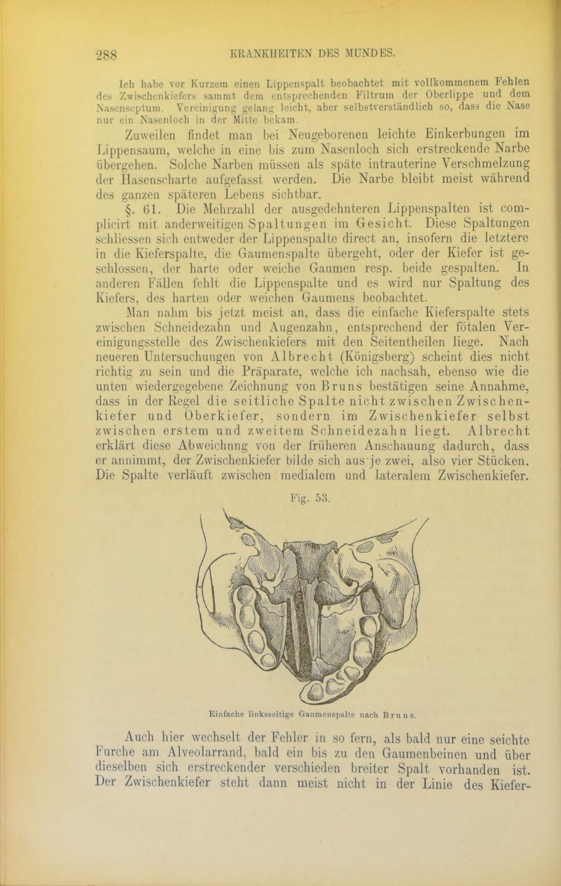 Ich habe vor Kurzem einen Lippenspalt beobachtet mit vollkommenem Fehlen des Zwischenkiefers sammt dem entsprechenden Filtrum der Oberlippe und dem Nasenscptum. Vereinigung gelang leicht, aber selbstverständlich so, dass die Nase nur ein Nasenloch in der Mitte bekam. Zuweilen findet man bei Neugeborenen leichte Einkerbungen im Lippensaum, welche in eine bis zum Nasenloch sich erstreckende Narbe übergehen. Solche Narben müssen als späte intrauterine Verschmelzung der Hasenscharte aufgefasst werden. Die Narbe bleibt raeist während des ganzen späteren Lebens sichtbar. §. 61. Die Mehrzahl der ausgedehnteren Lippenspalten ist com- plicirt mit anderweitigen Spaltungen im Gesicht. Diese Spaltungen schliessen sich entweder der Lippenspalte direct an, insofern die letztere in die Kieferspalte, die Gaumenspalte übergeht, oder der Kiefer ist ge- schlossen, der harte oder weiche Gaumen resp. beide gespalten. In anderen Fällen fehlt die Lippenspalte und es wird nur Spaltung des Kiefers, des harten oder weichen Gaumens beobachtet. Man nahm bis jetzt meist an, dass die einfache Kieferspalte stets zwischen Schneidezahn und Augenzahn, entsprechend der fötalen Ver- einigungsstelle des Zwischenkiefers mit den Seitentheilen liege. Nach neueren Untersuchungen von Albrecht (Königsberg) scheint dies nicht richtig zu sein und die Präparate, welche ich nachsah, ebenso wie die unten wiedergegebene Zeichnung von Bruns bestätigen seine Annahme, dass in der Regel die seitliche Spalte nicht zwischen Zwischen- kiefer und Oberkiefer, sondern im Zwischenkiefer selbst zwischen erstem und zweitem Schneidezahn liegt. Albrecht erklärt diese Abweichung von der früheren Anschauung dadurch, dass er annimmt, der Zwischenkiefer bilde sich aus je zwei, also vier Stücken. Die Spalte verläuft zwischen medialem und lateralem Zwischenkiefer. Auch hier wechselt der Fehler in so fern, als bald nur eine seichte Furche am Alveolarrand, bald ein bis zu den Gaumenbeinen und über dieselben sich erstreckender verschieden breiter Spalt vorhanden ist. Der Zwischenkiefer steht dann meist nicht in der Linie des Kiefer- Fig. 53. Einfache linksseitige Gaumenspalte nach Bruns.