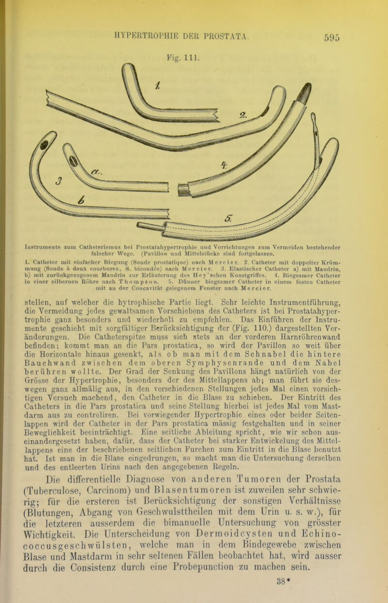 Fig. Iii. Instrumente zum Catlieterisiuus bei Prostatahypertrophie and Vorrichtungen zum Vermeiden bestehender falscher Wege. (Pavillon und Mittelstücke sind fortgelassen. 1. Catheter mit einfacher Biegung (Sonde prostatique) nach Mercier. 2. Catheter mit doppelter Krüm- mung (Sonde ä deux eourbures, S. bicondt'e) nach Mercier. 3. Elastischer Catheter a) mit Mandrin, b) mit zurückgezogenem Mandrin zur Erläuterung des Hey'schen Kunstgriffes. 4. Biegsamer Catheter in einer silbernen Röhre nach Thompson. f>. Dünner biegsamer Catheter in einem festen Catheter mit an der Concavität gelegenem Fenster nach Mercier. stellen, auf welcher die hytrophische Partie liegt. Sehr leichte Instrumentführung, die Vermeidung jedes gewaltsamen Vorschiebens des Catheters ist bei Prostatahyper- trophie ganz besonders und wiederholt zu empfehlen. Das Einführen der Instru- mente geschieht mit sorgfältiger Berücksichtigung der (Fig. 110.) dargestellten Ver- änderungen. Die Catheterspitze muss sich stets ein der vorderen Harnröhrenwand befinden; kommt man an die Pars prostatica, so wird der Pavillon so weit über die Horizontale hinaus gesenkt, als ob man mit dem Schnabel die hintere Bauchwand zwischen dem oberen Sy mphy senrande und dem Nabel berühren wollte. Der Grad der Senkung des Pavillons hängt natürlich von der Grösse der Hypertrophie, besonders der des Mittellappens ab; man führt sie des- wegen ganz allmälig aus, in den verschiedenen Stellungen jedes Mal einen vorsich- tigen Versuch machend, den Catheter in die Blase zu schieben. Der Eintritt des Catheters in die Pars prostatica und seine Stellung hierbei ist jedes Mal vom Mast- darm aus zu controliren. Bei vorwiegender Hypertrophie eines oder beider Seiten- lappen wird der Catheter in der Pars prostatica mässig festgehalten und in seiner Beweglichkeit beeinträchtigt. Eine seitliche Ableitung spricht, wie wir schon aus- einandergesetzt haben, dafür, dass der Catheter bei starker Entwickelung des Mittel- lappens eine der beschriebenen seitlichen Furchen zum Eintritt in die Blase benutzt hat. Ist man in die Blase eingedrungen, so macht man die Untersuchung derselben und des entleerten Urins nach den angegebenen Regeln. Die differentielle Diagnose von anderen Tumoren der Prostata (Tuberculose, Carcinom) und Blasentumoren ist zuweilen sehr schwie- rig; für die ersteren ist Berücksichtigung der sonstigen Verhältnisse (Blutungen, Abgang von Geschwulsttheilen mit dem Urin u. s. w.), für die letzteren ausserdem die bimanuelle Untersuchung von grösster Wichtigkeit. Die Unterscheidung von Dermoidcysten und Echino- coccus ge schwülsten, welche man in dem Bindegewebe zwischen Blase und Mastdarm in sehr seltenen Fällen beobachtet hat, wird ausser durch die Consistenz durch eine Probepunction zu machen sein. 38*