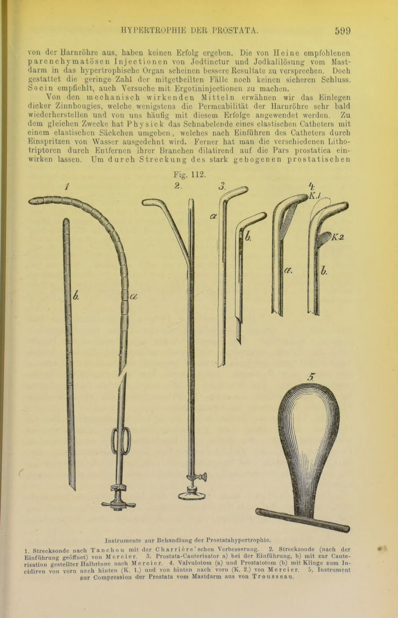 von der Harnröhre aus, haben keinen Erfolg ergeben. Die von Heine empfohlenen parenchymatösen Injectionen von Jodtinctur und Jodkalilösung vom Mast- darm in das hypertrophische Organ scheinen bessere Resultate zu versprechen. Doch gestattet die geringe Zahl der mitgetbeilten Fälle noch keinen sicheren Schluss. So ein empfiehlt, auch Versuche mit Ergotininjectionen zu machen. Von den mechanisch wirkenden Mitteln erwähnen wir das Hinlegen dicker Zinnbougies, welche wenigstens die Permeabilität der Harnröhre sehr bald wiederherstellen und von uns häufig mit diesem Erfolge angewendet werden. Zu dem gleichen Zwecke hat Physick das Schnabelende eines elastischen Catheters mit einem elastischen Säckchen umgeben, welches nach Einlühren des Catheters durch Einspritzen von Wasser ausgedehnt wird. Ferner hat man die verschiedenen Litho- triptoren durch Entfernen ihrer Branchen dilatirend auf die Pars prostatica ein- wirken lassen. Um durch Streckung des stark gebogenen prostatischen Fig. 112. Instrumente zur Behandlung der Prostatahypertrophic. L Strecksonde nach Tanc.hou mit der C h a rri e re' sehen Verbesserung. 2. Strecksondc (nach der Einführung geöffnet) von Mcrcier. 3. Prostata-L'auterisator a) bei der Einführung, l>) mit zur Cante- risation gestellter Halbrinne nach Mcrcier. 4. Valvulotom (a) und Prostatotnm (b) mit Klinge zum In- cidiren von vorn nach hinten (K. 1.) und von hinten nach vorn (K. 2.) von Mcrcier. 5. Instrument zur Compressiou der Prostata vom Mastdarm aus von Trousseau.